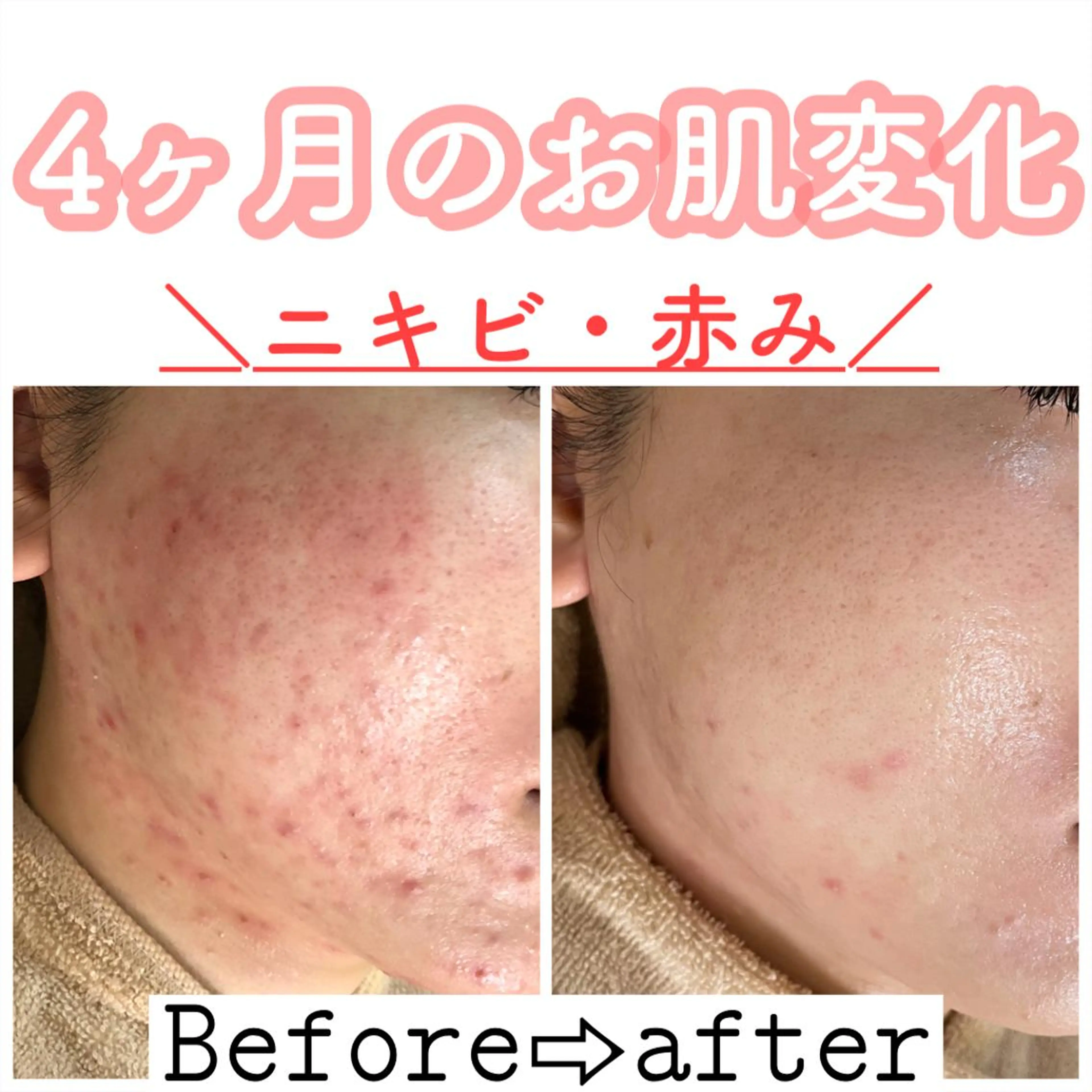 ショート カラー パーマ ヘアアレンジ メンズ キッズ ネイル マツエク・マツパ ニキビ&跡改善サロン オーナー光木のエステ・リラクイメージ