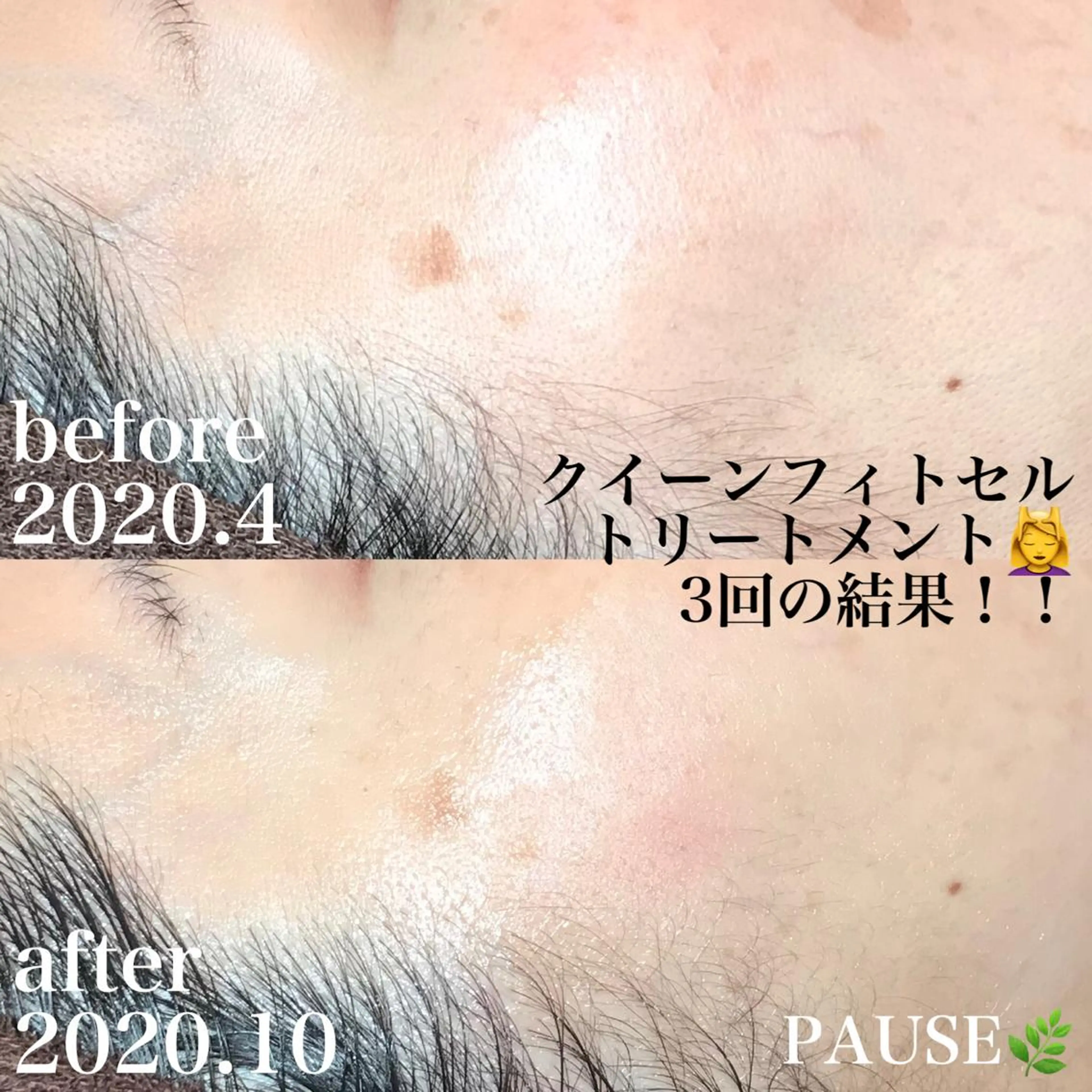 エステ 浜野 恵美のエステ・リラクイメージ