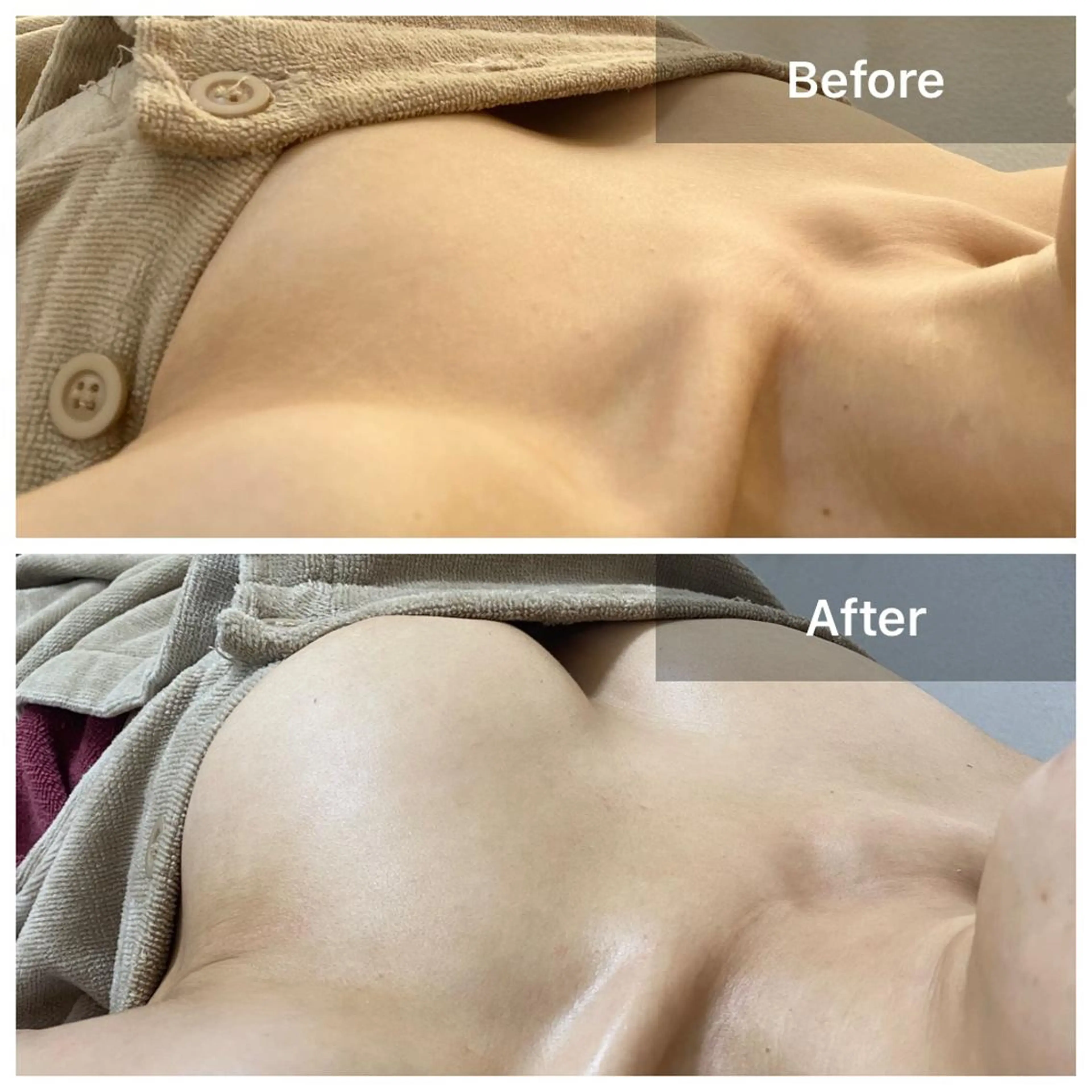 ミニモ限定！バストケアNo1！ マシュマロバストアップ♡産後ケア/ハリなしポヨポヨ胸/日常生活での肩こりの方必見！！の写真