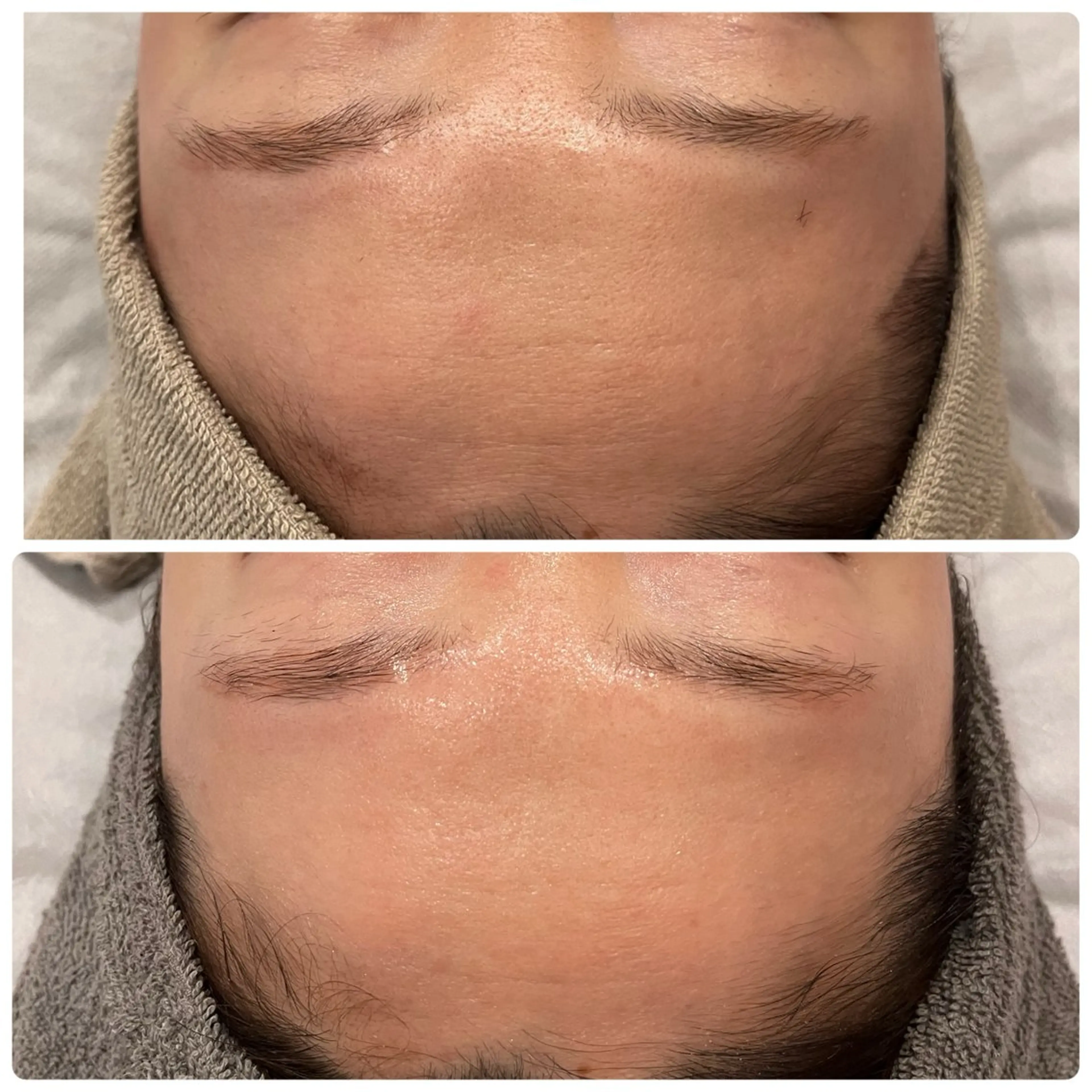 脱毛 yellow.所属・yellow💛【 脱毛&フェイシャル】のエステ・リラクイメージ