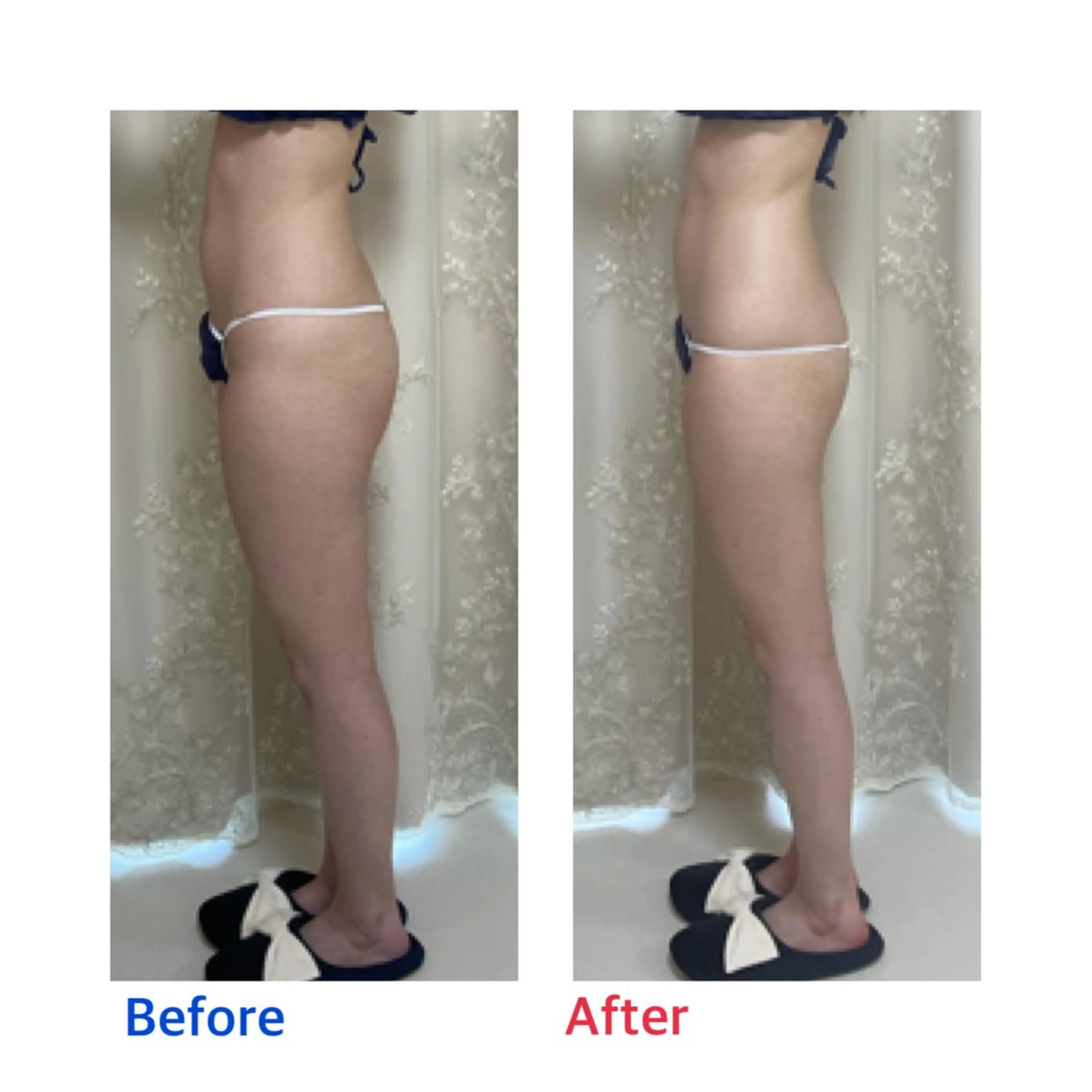 エステ リラク プライベートサロンmoyo所属・プライベートサロン moyoのエステ・リラクイメージ