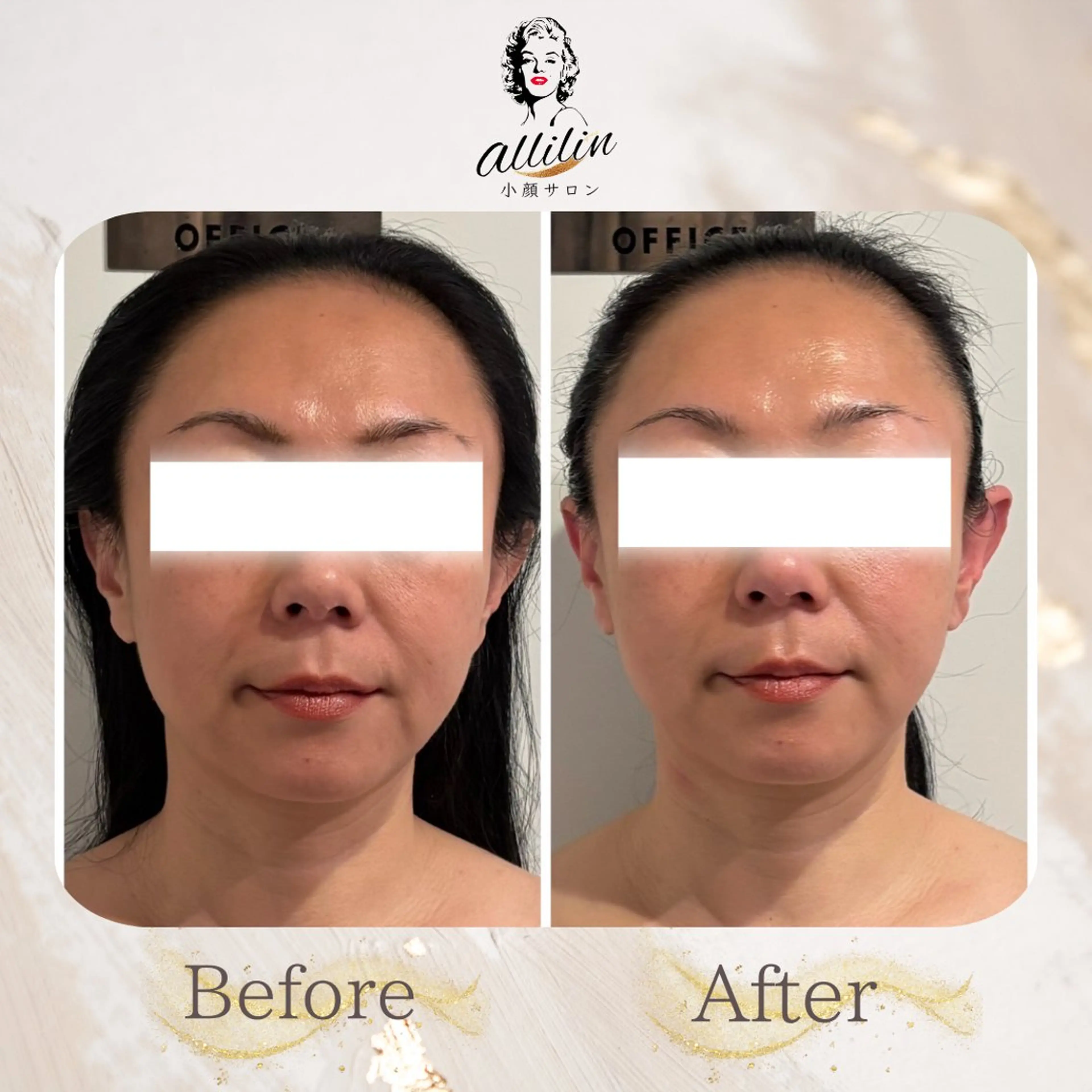 小顔サロンallilin所属・💎allilin 五所川原💎本間のエステ・リラクイメージ