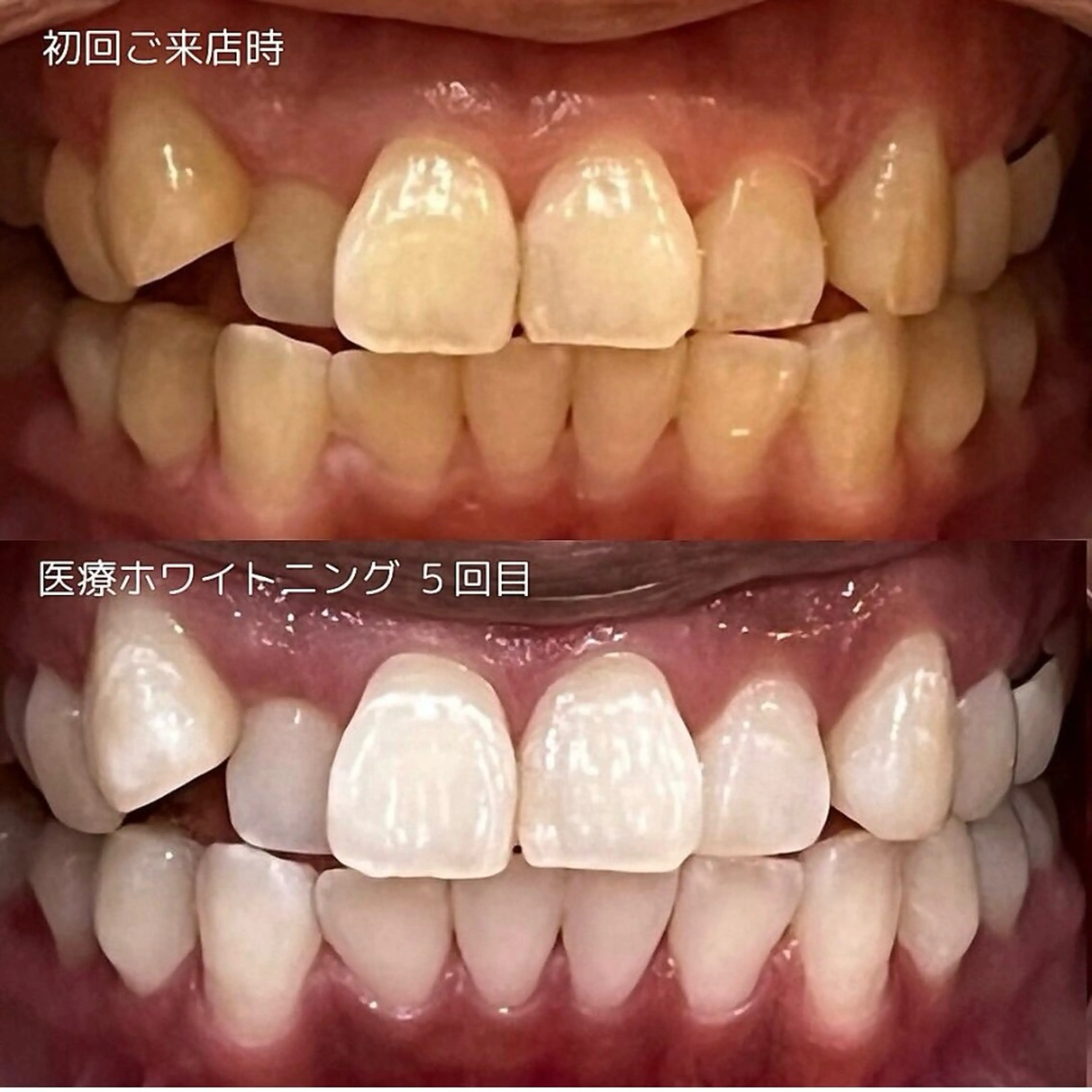 その他 salon 87 【サロン　ハナ】のその他イメージ