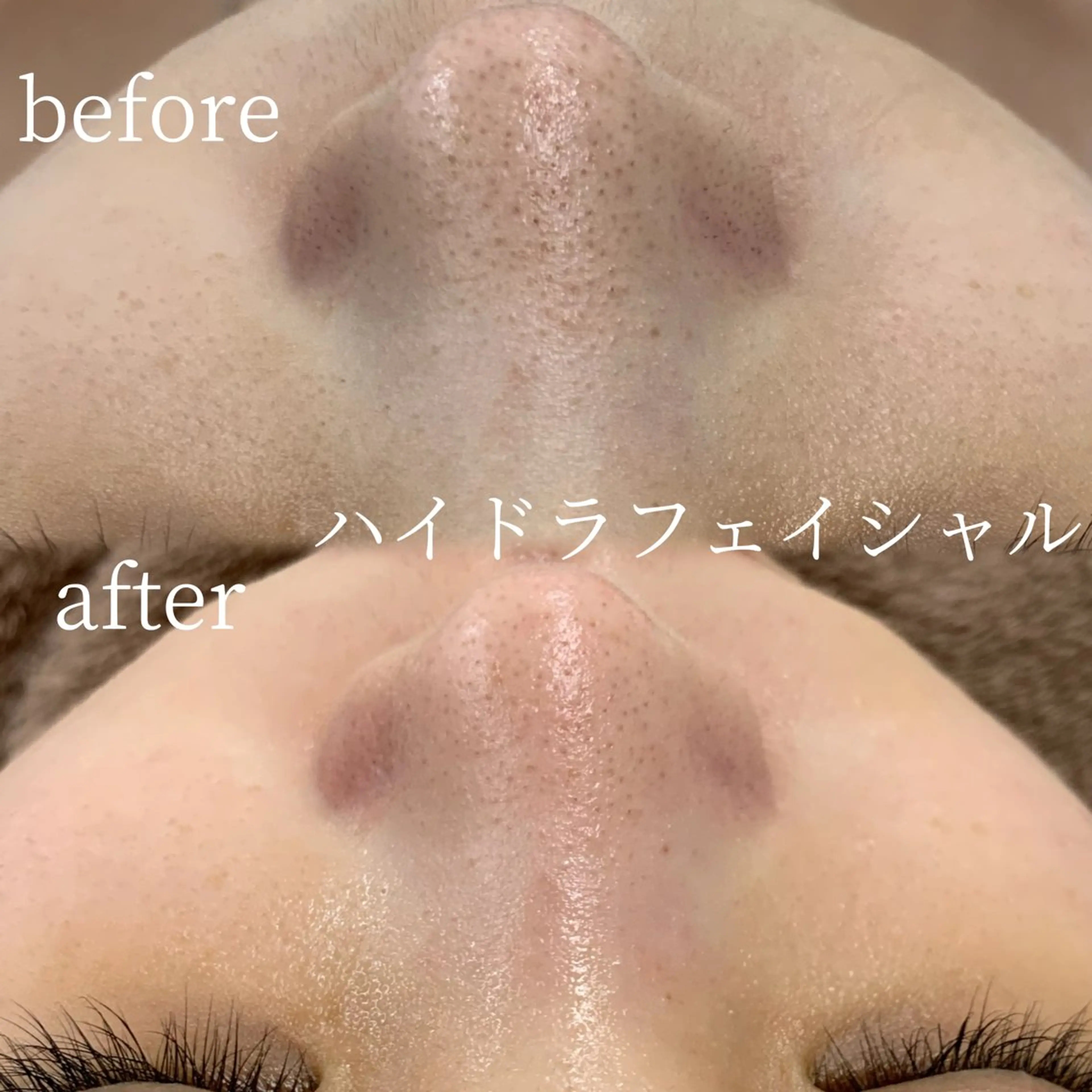 エステ リラク lifra CHISAのマツエク・マツパデザイン