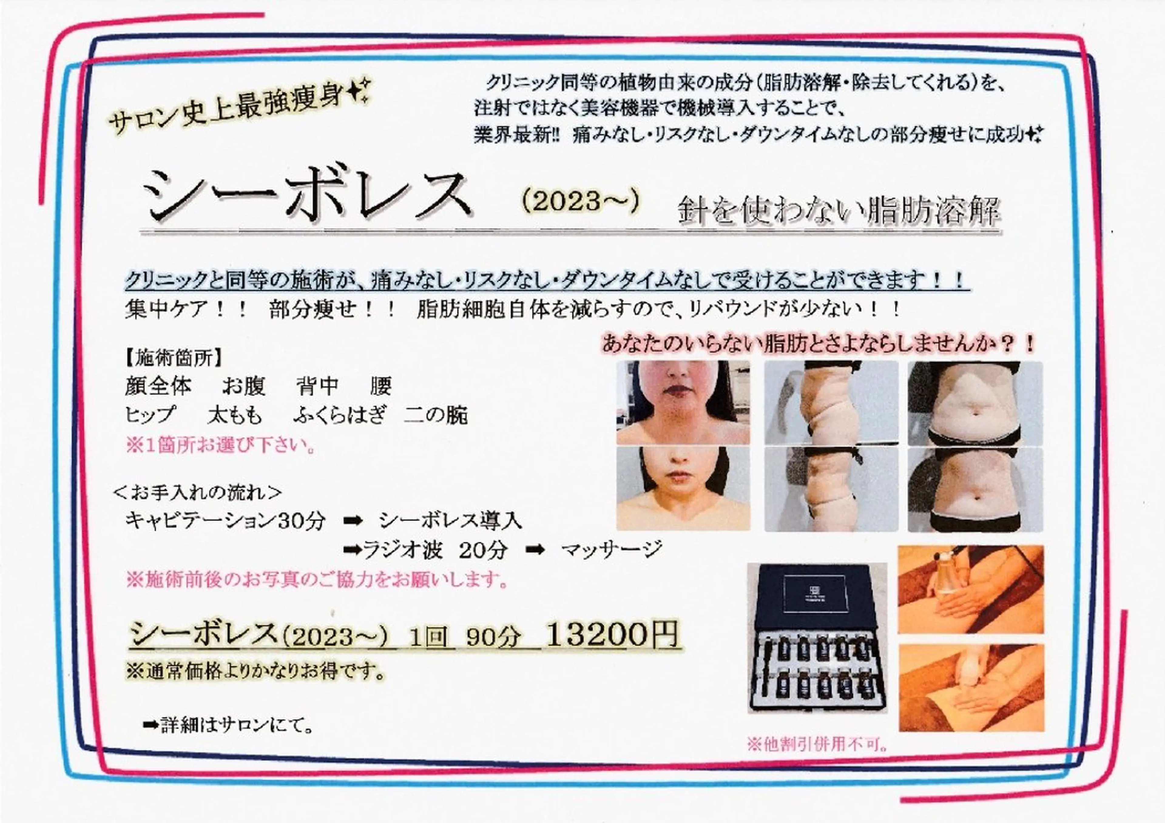 お🉐新痩身＆小顔✨シーボレス2023〜　クリニック同等のケアで頑固な脂肪と楽してさよなら👋　※メンズ可の写真