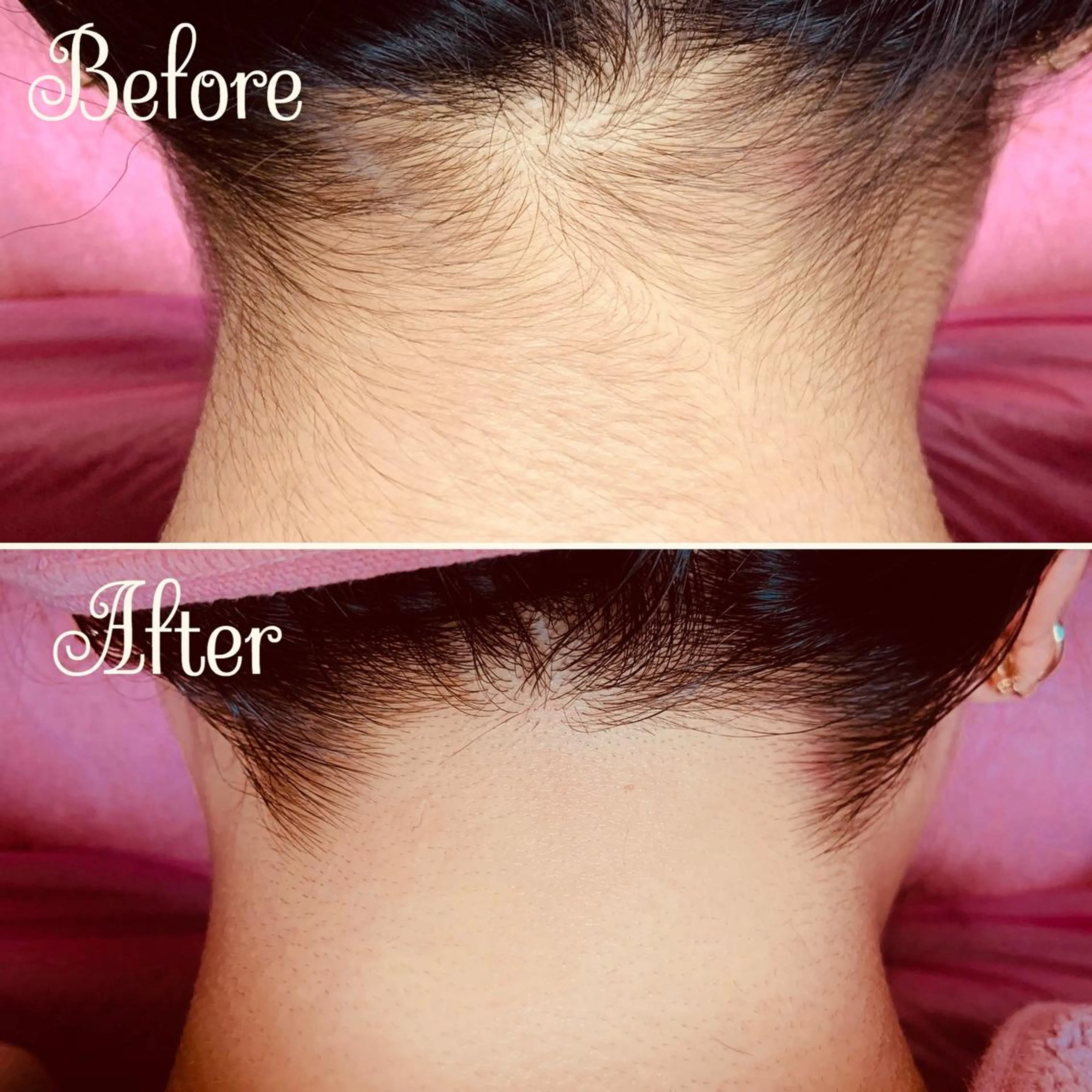 脱毛 透明感の肌Lino malieのエステ・リラクイメージ