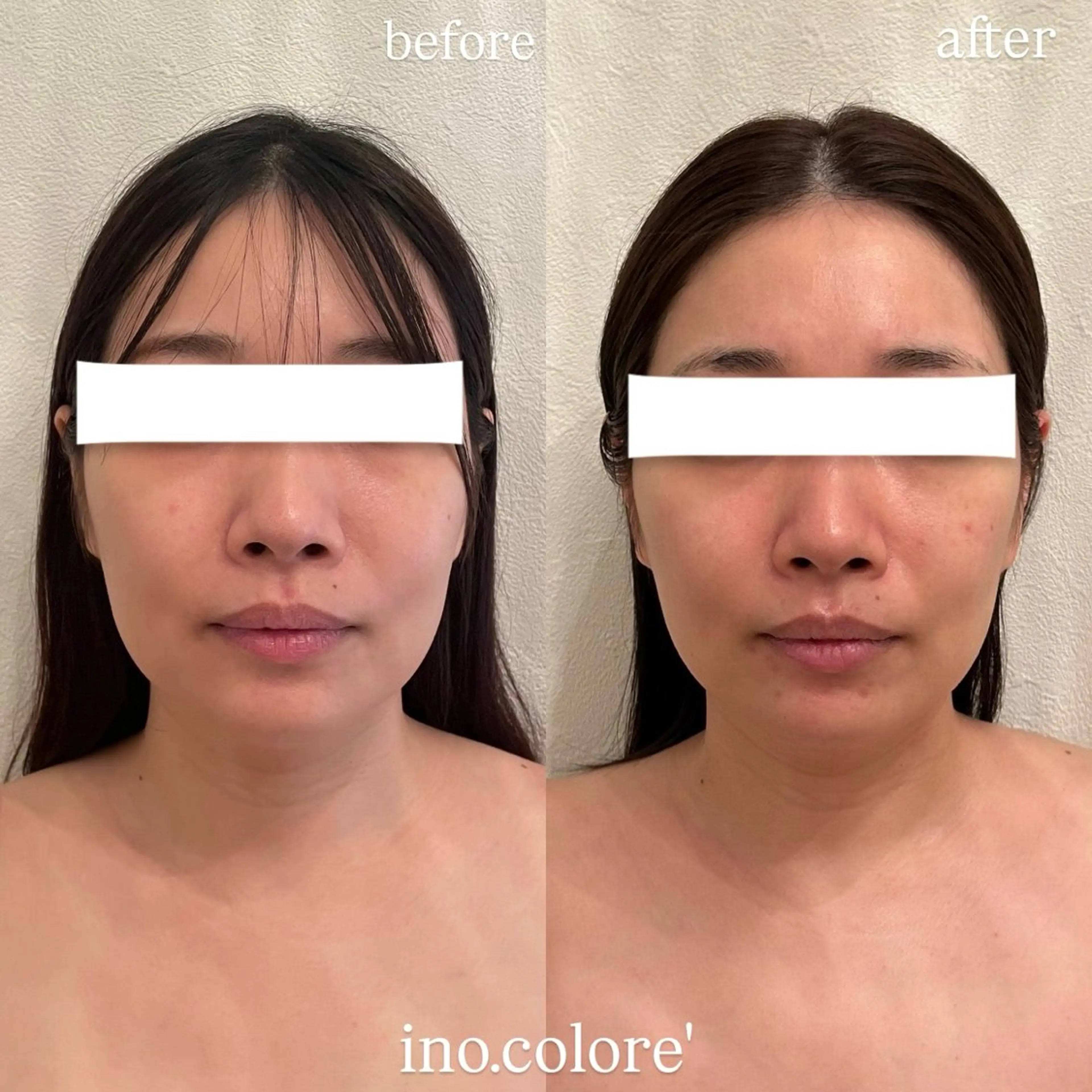 エステサロンino.colore'所属・小顔サロン ino.coloreのエステ・リラクイメージ