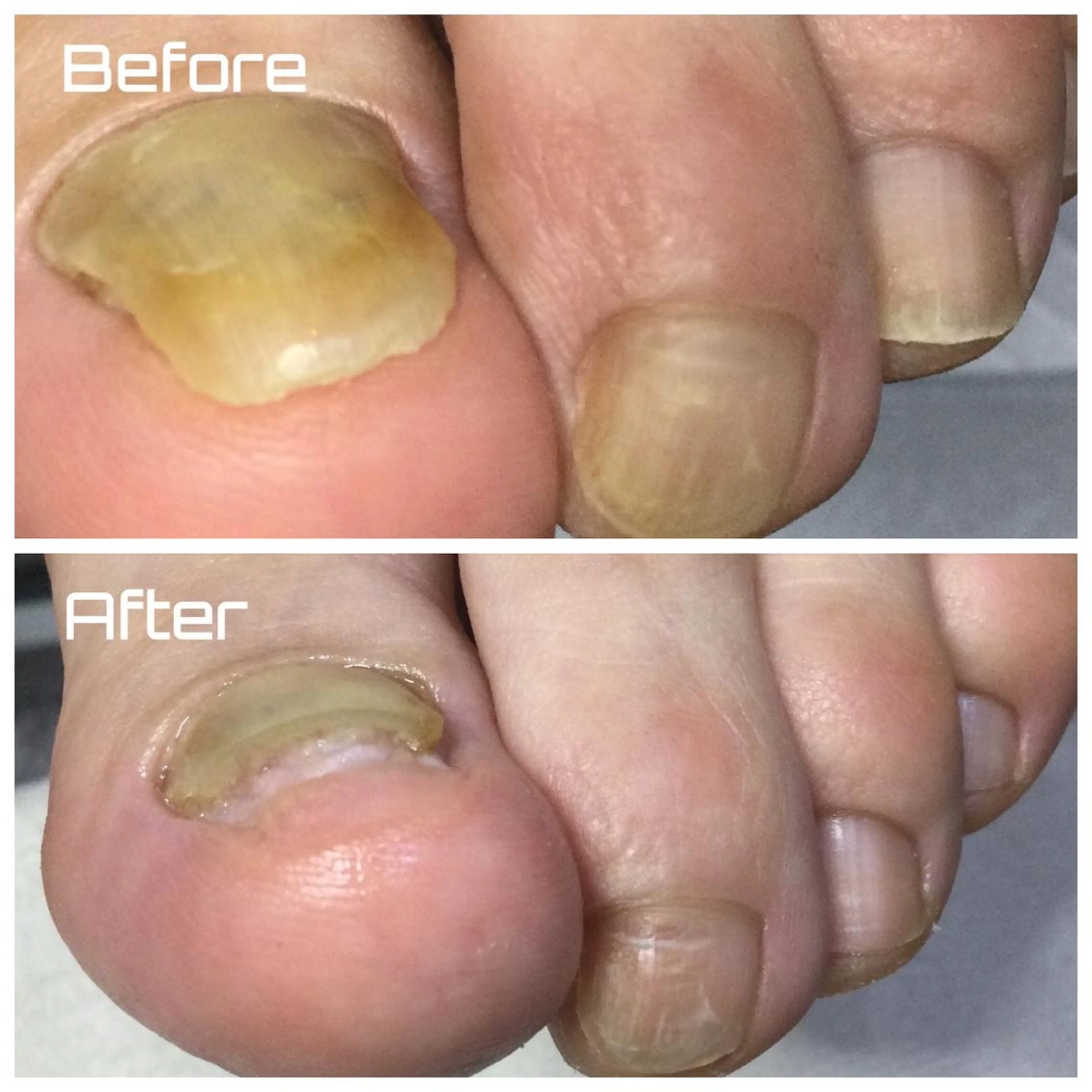 その他 ドクターネイル爪革命 takahashiのその他イメージ