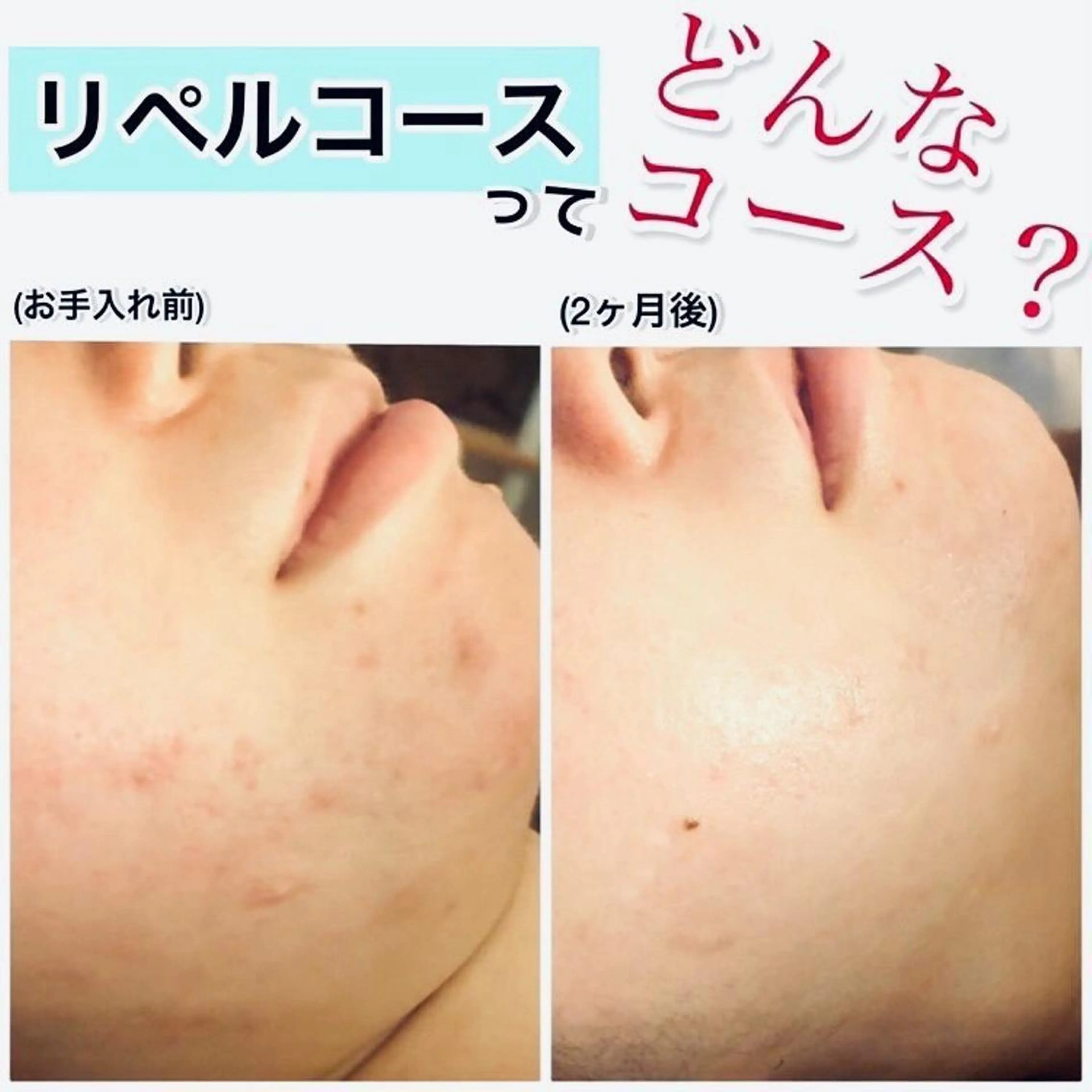 エステ リラク ペリドットラボ naoのエステ・リラクイメージ