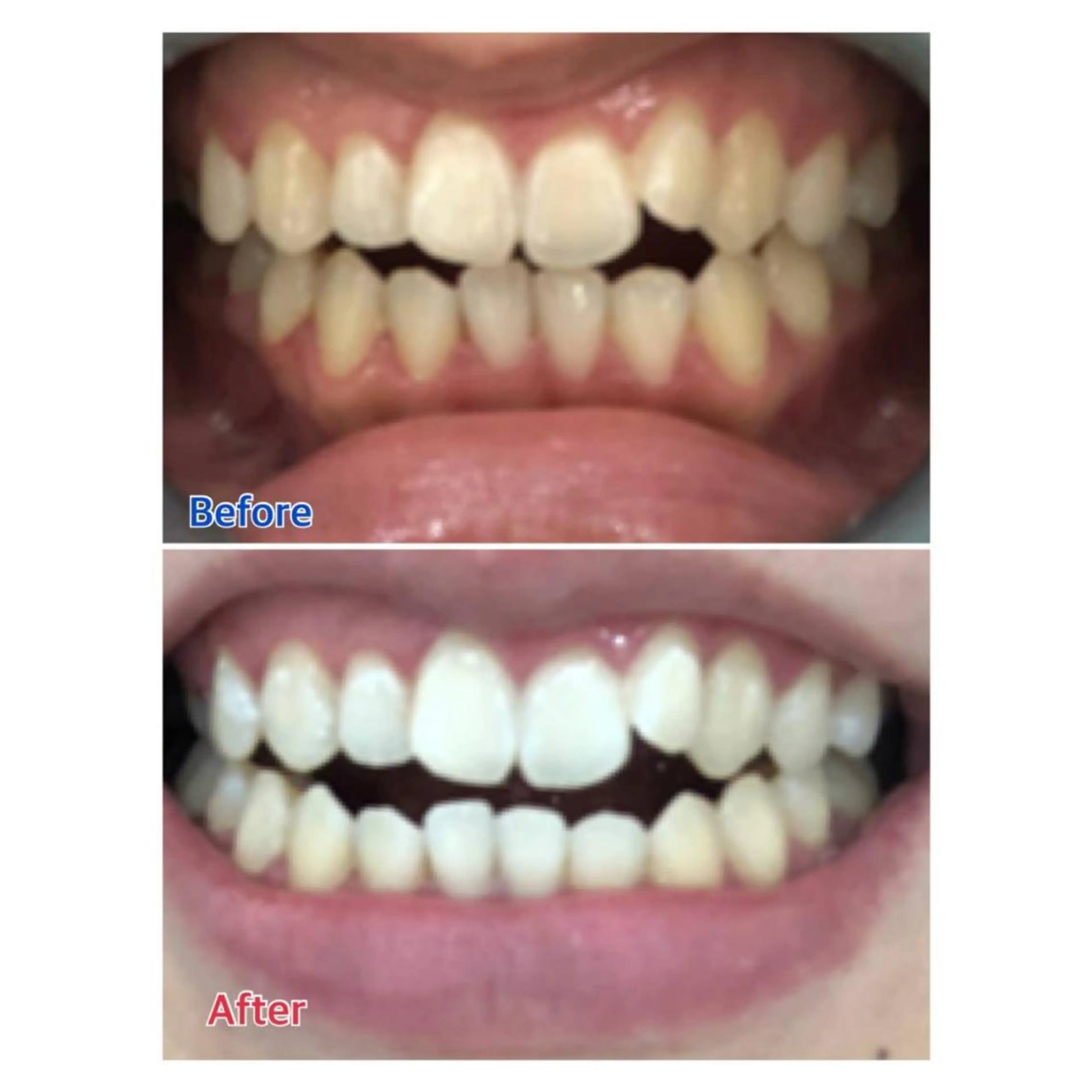 MBEAUTYSALON 千葉店・京成大久保所属・Melty 輝のその他イメージ