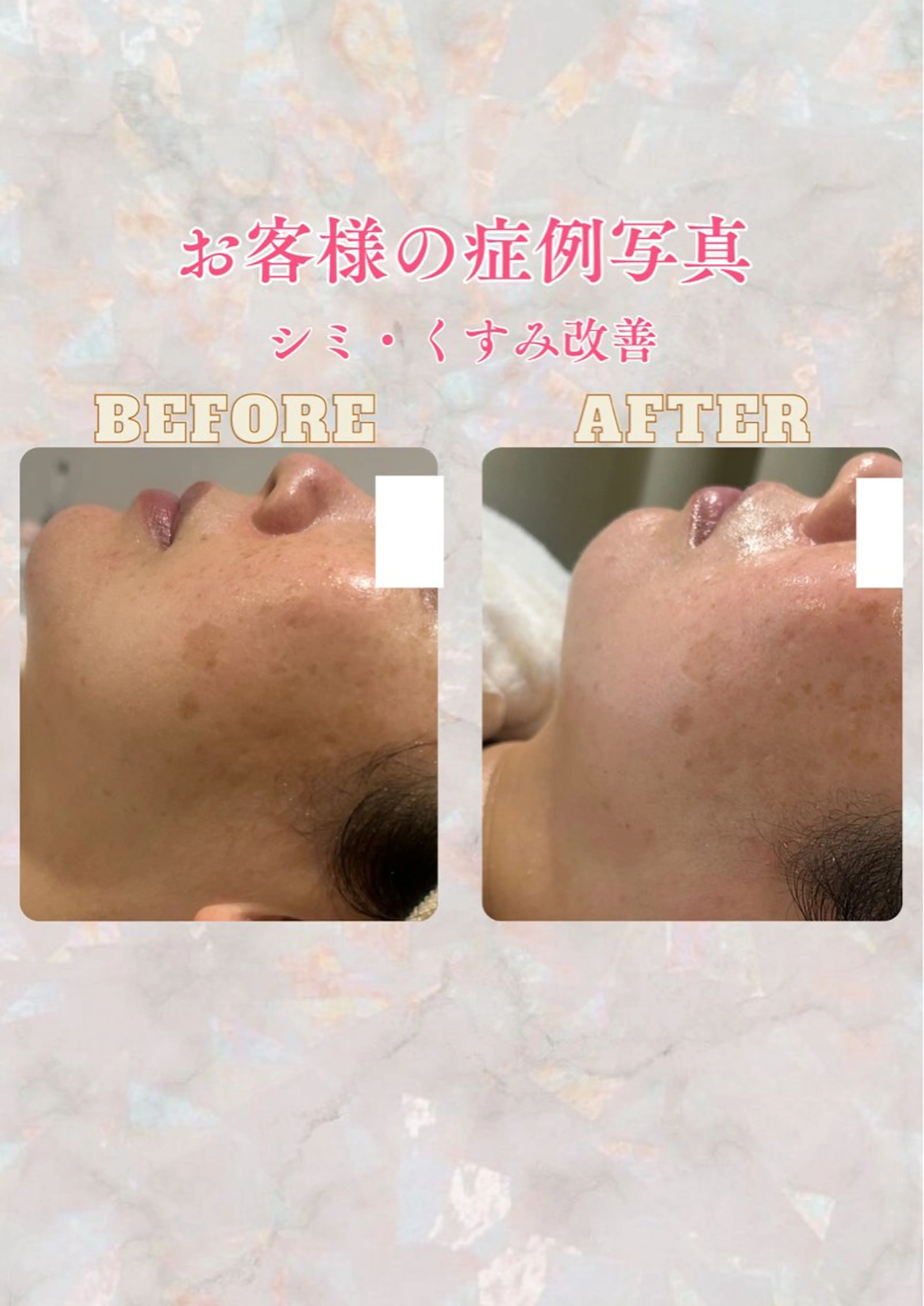 エステ pansy(パンジー)上野フェイシャルエステ専門店所属・pansy saraのエステ・リラクイメージ