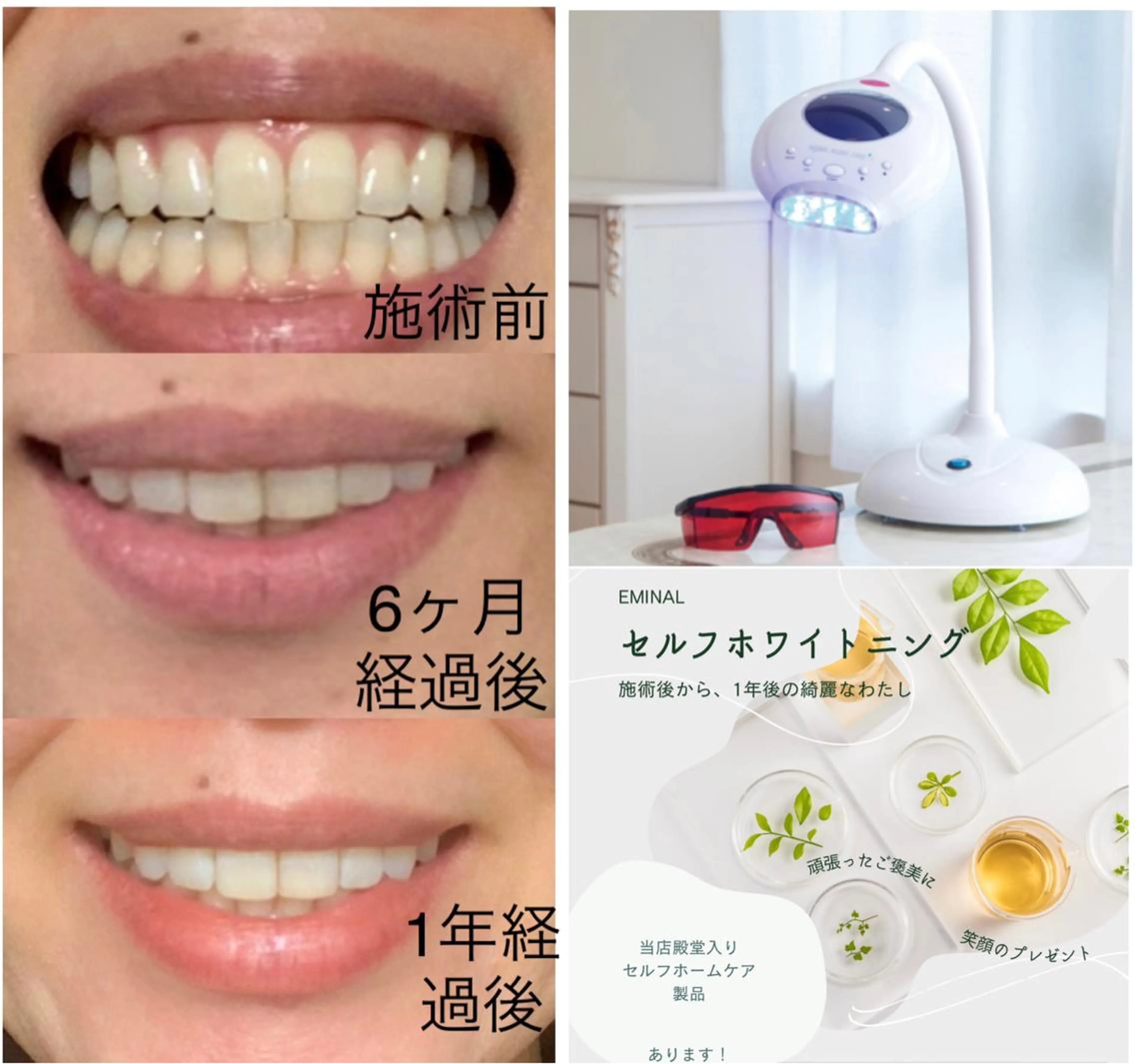 整体フェイシャル EMINALのエステ・リラクイメージ