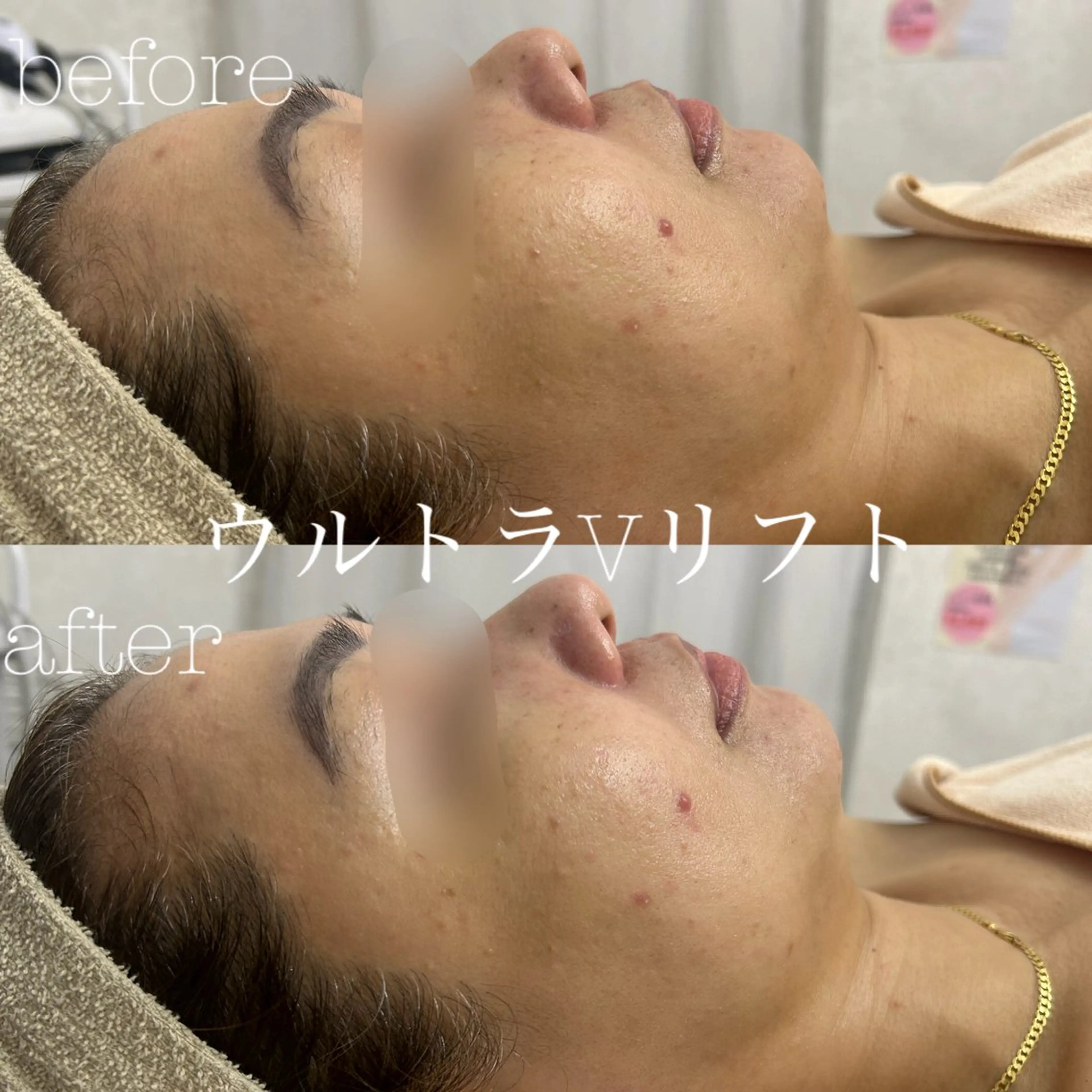 エステ フェイシャルサロン CHIARA 荒田のエステ・リラクイメージ