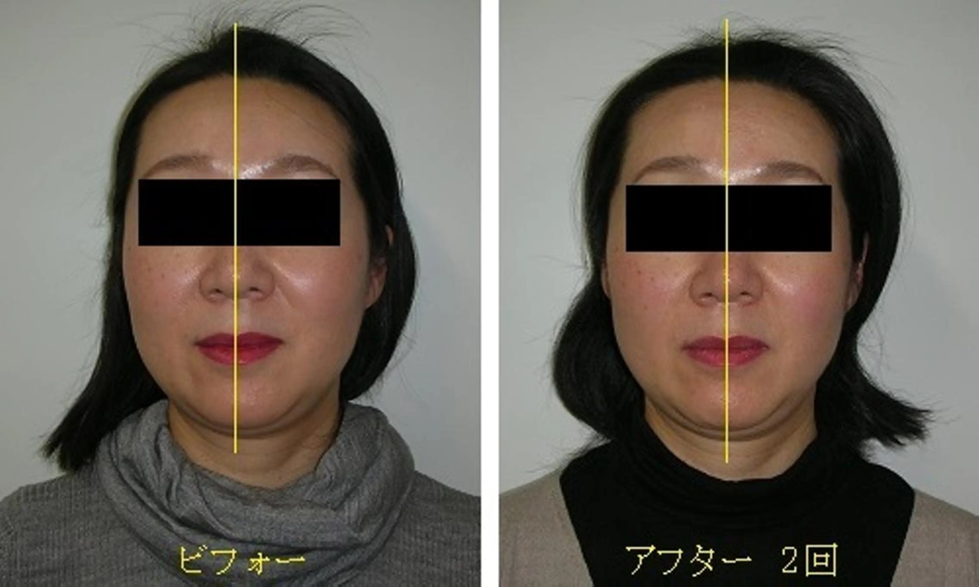 吉信 　のエステ・リラクイメージ