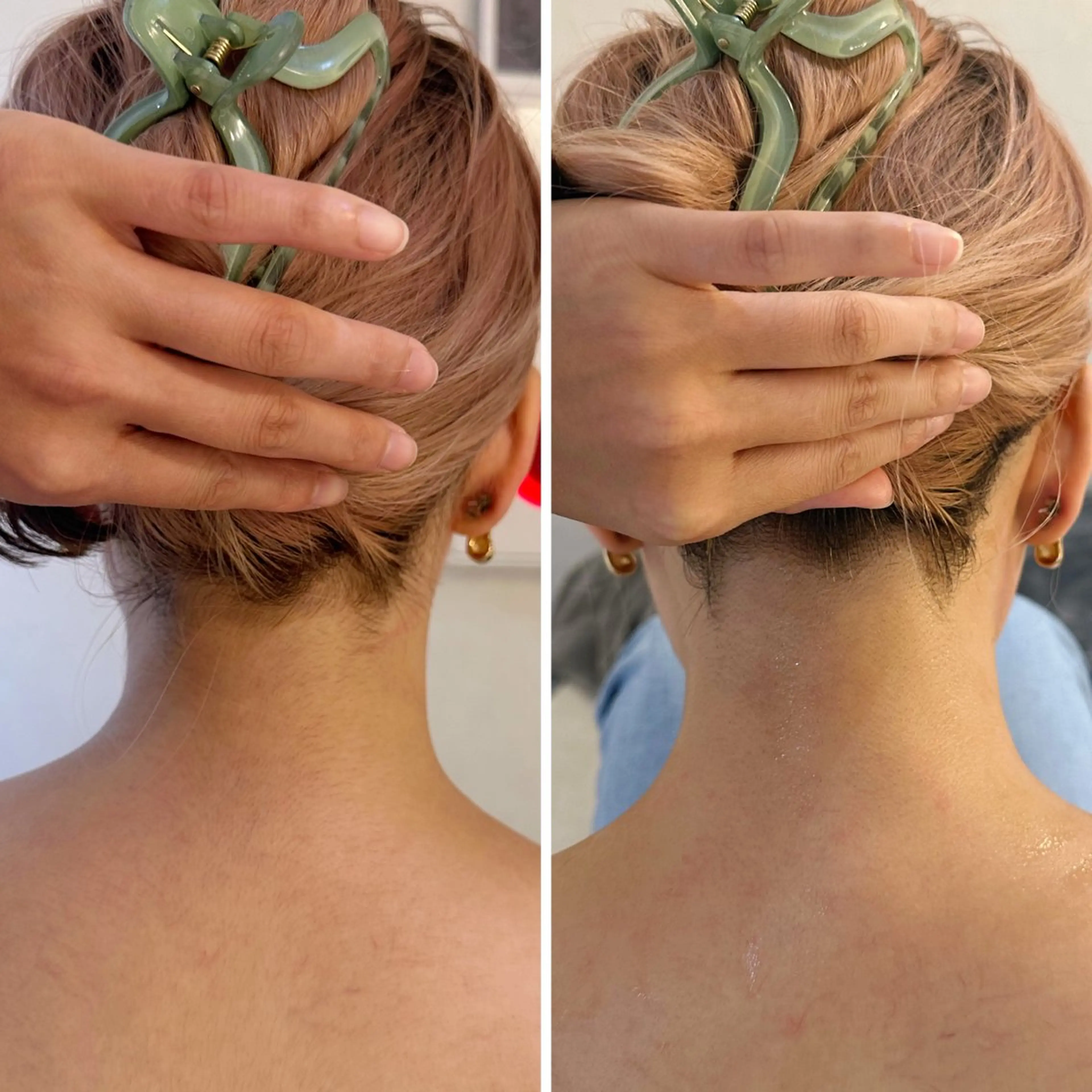 脱毛 うなじ脱毛/美肌脱毛 LABELのエステ・リラクイメージ