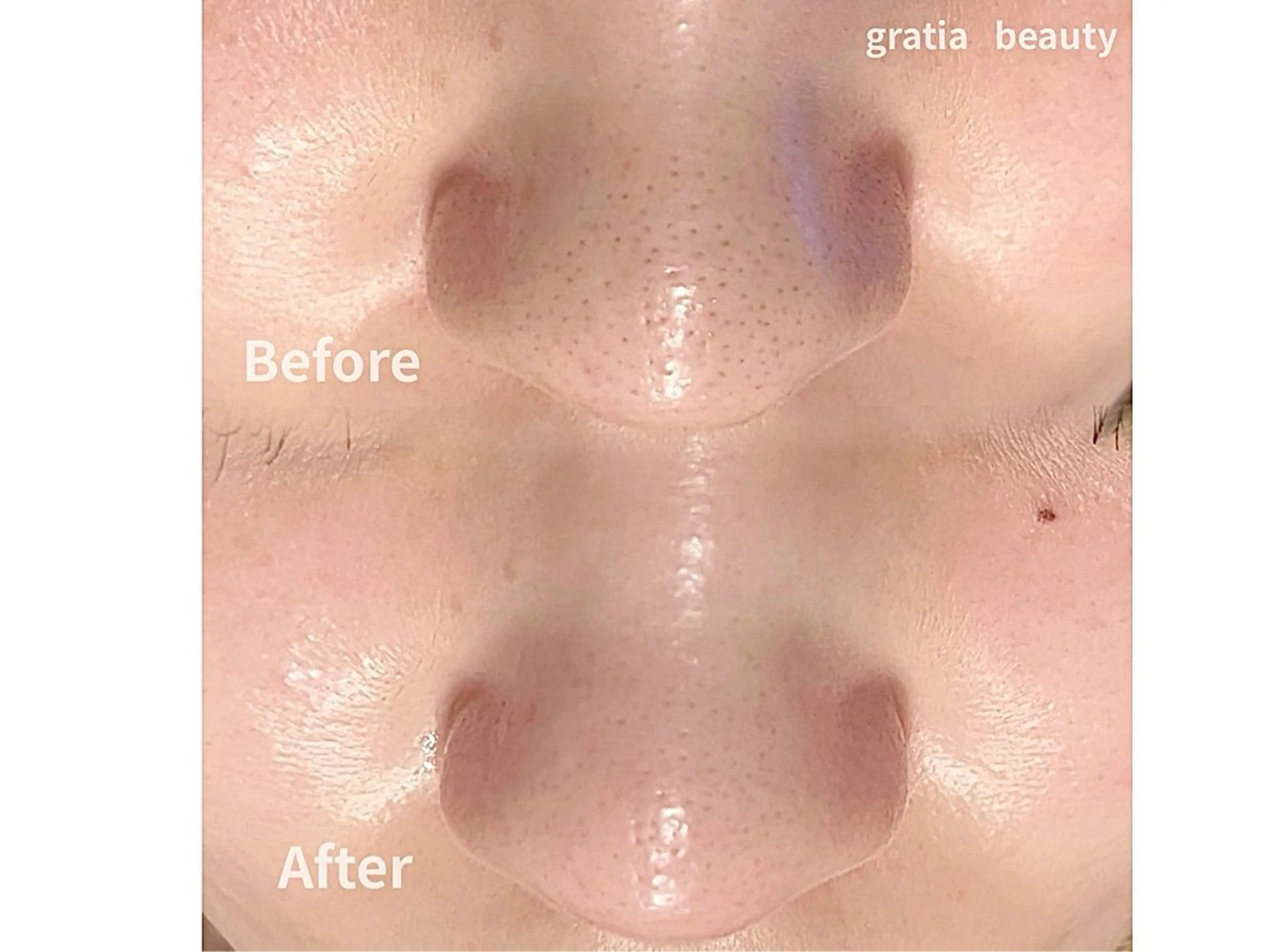 エステ gratia eyelash･nail･beauty所属・gratia salonのエステ・リラクイメージ