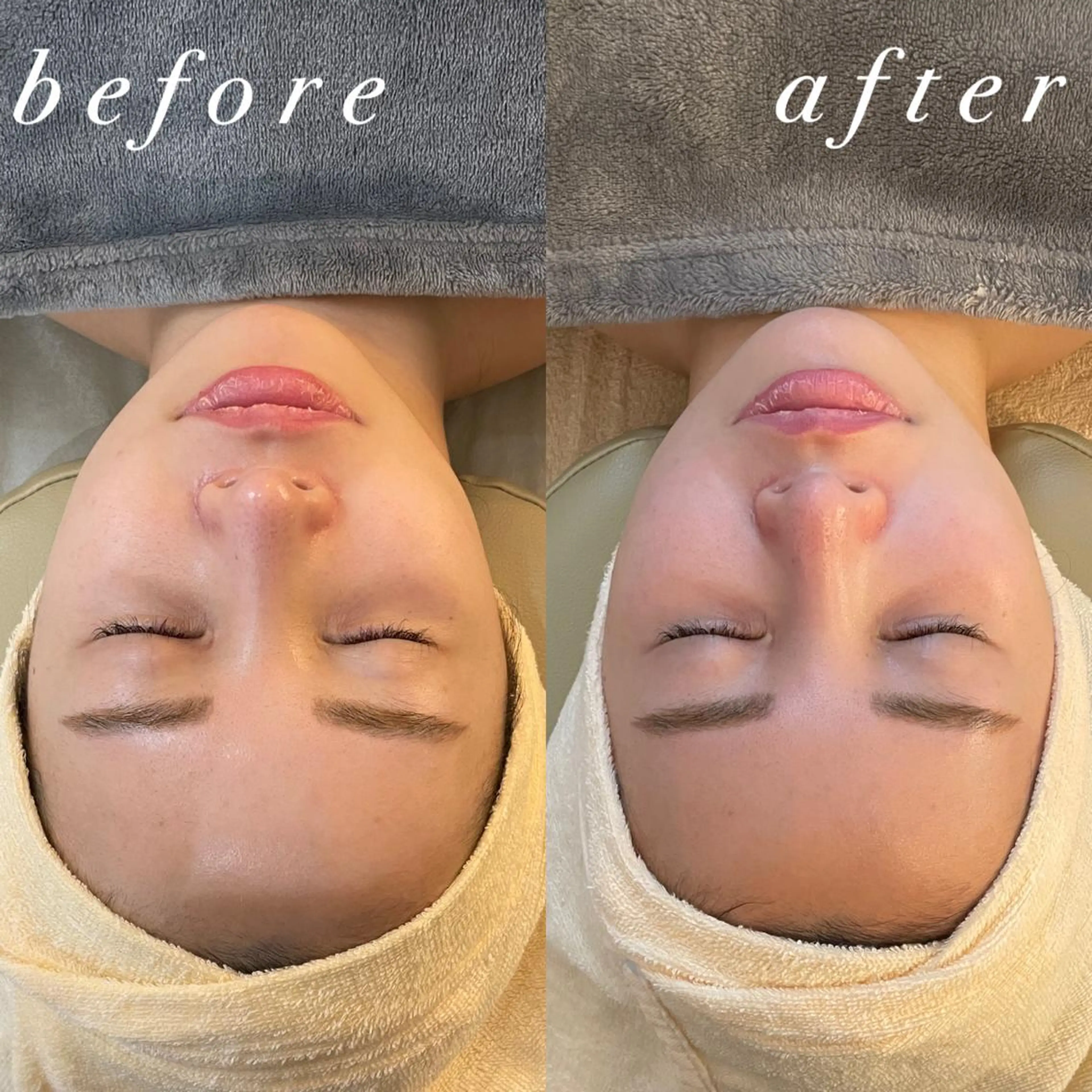 うなじ脱毛/美肌脱毛 LABELのエステ・リラクイメージ