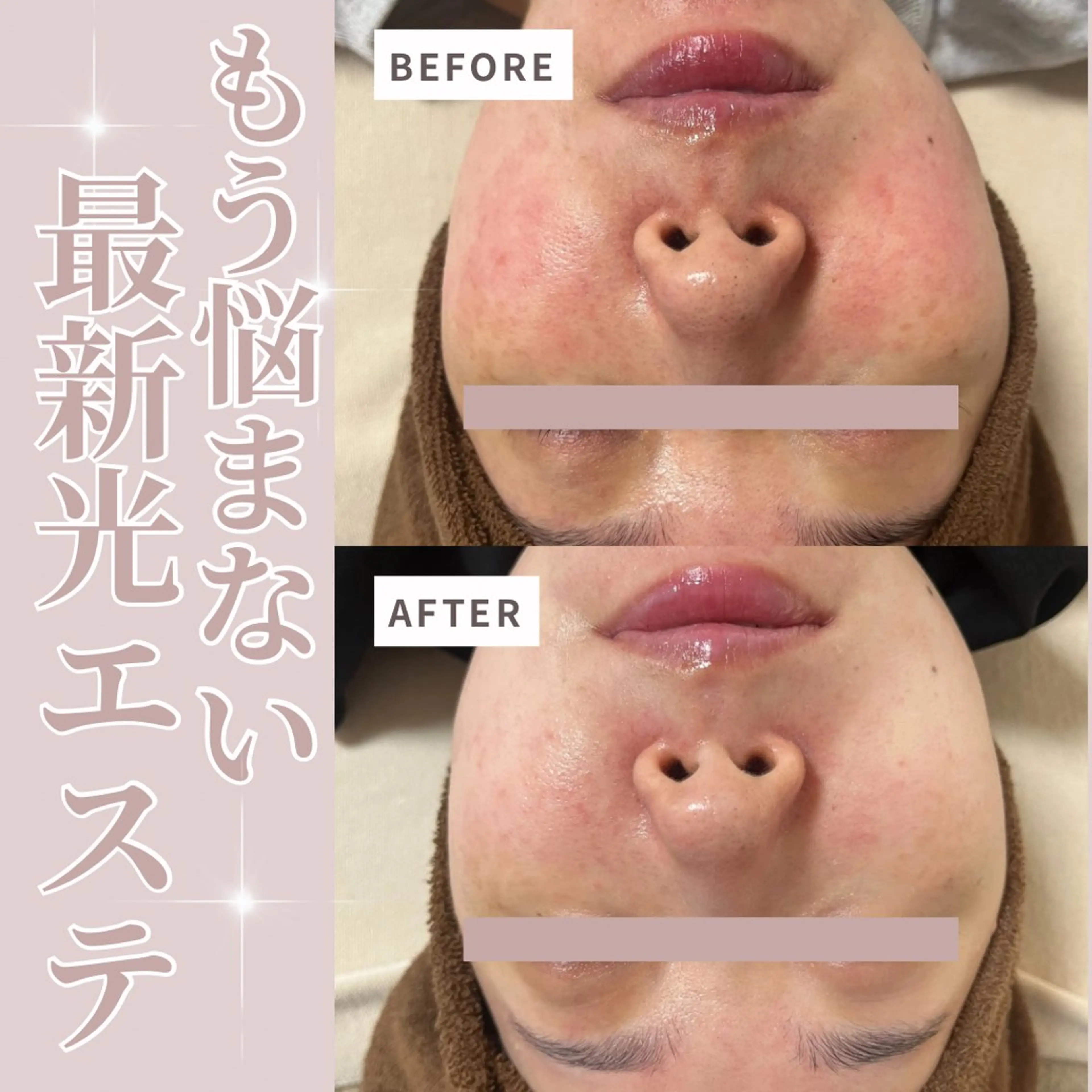 エステ salon More所属・出口 玲菜のエステ・リラクイメージ