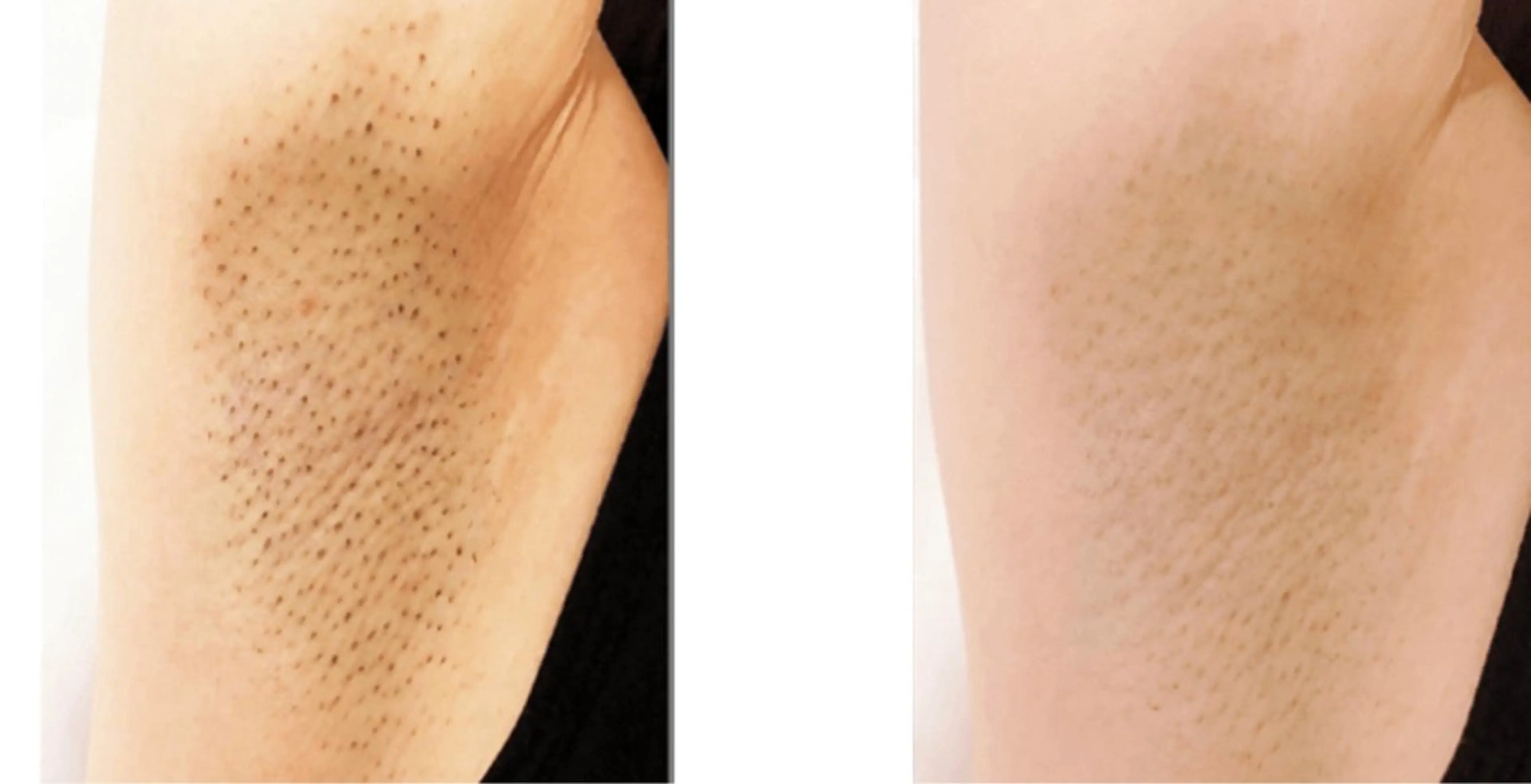 脱毛・美肌サロン Epi Houseのエステ・リラクイメージ