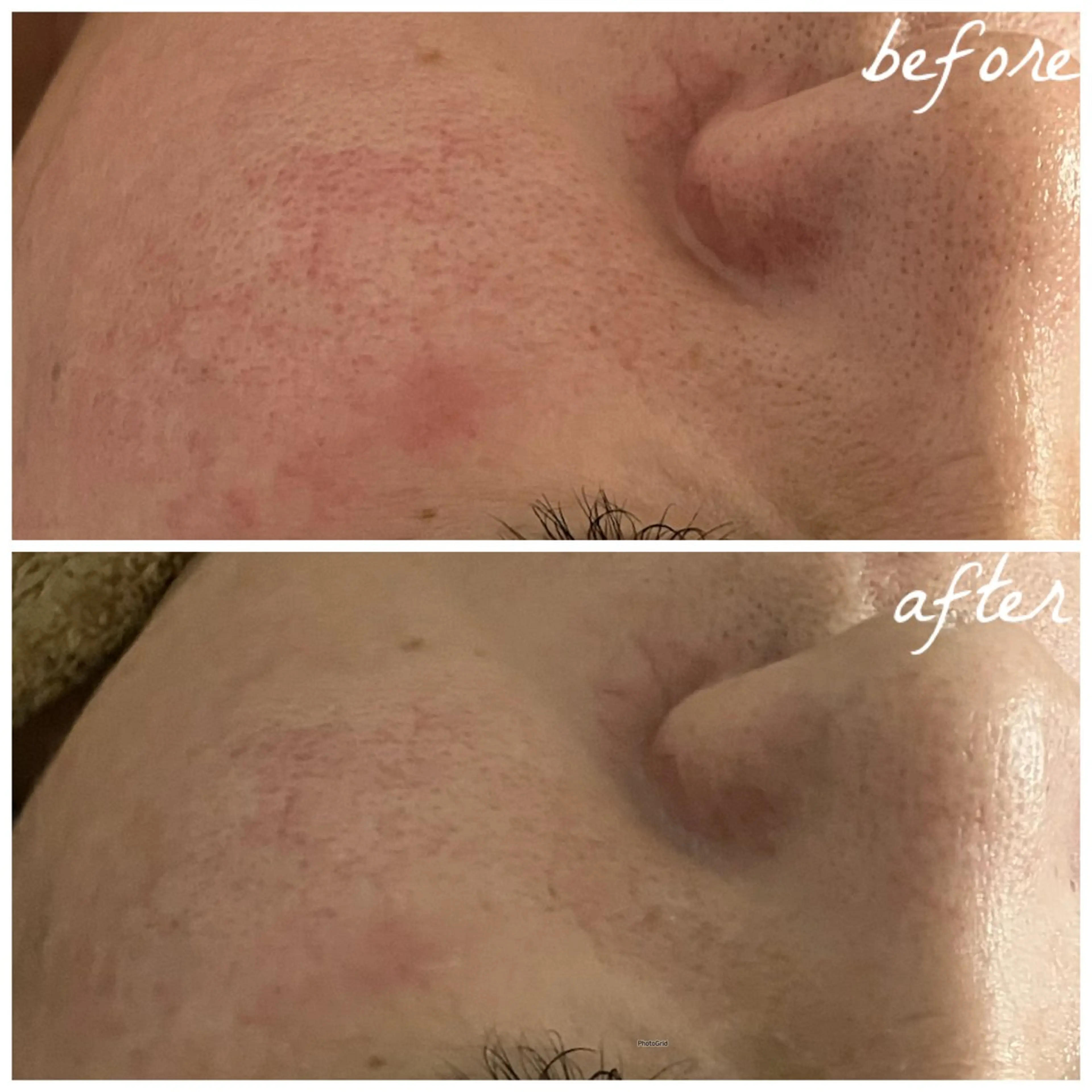 メンズ エステ メナード岐阜茜部 杉浦のエステ・リラクイメージ