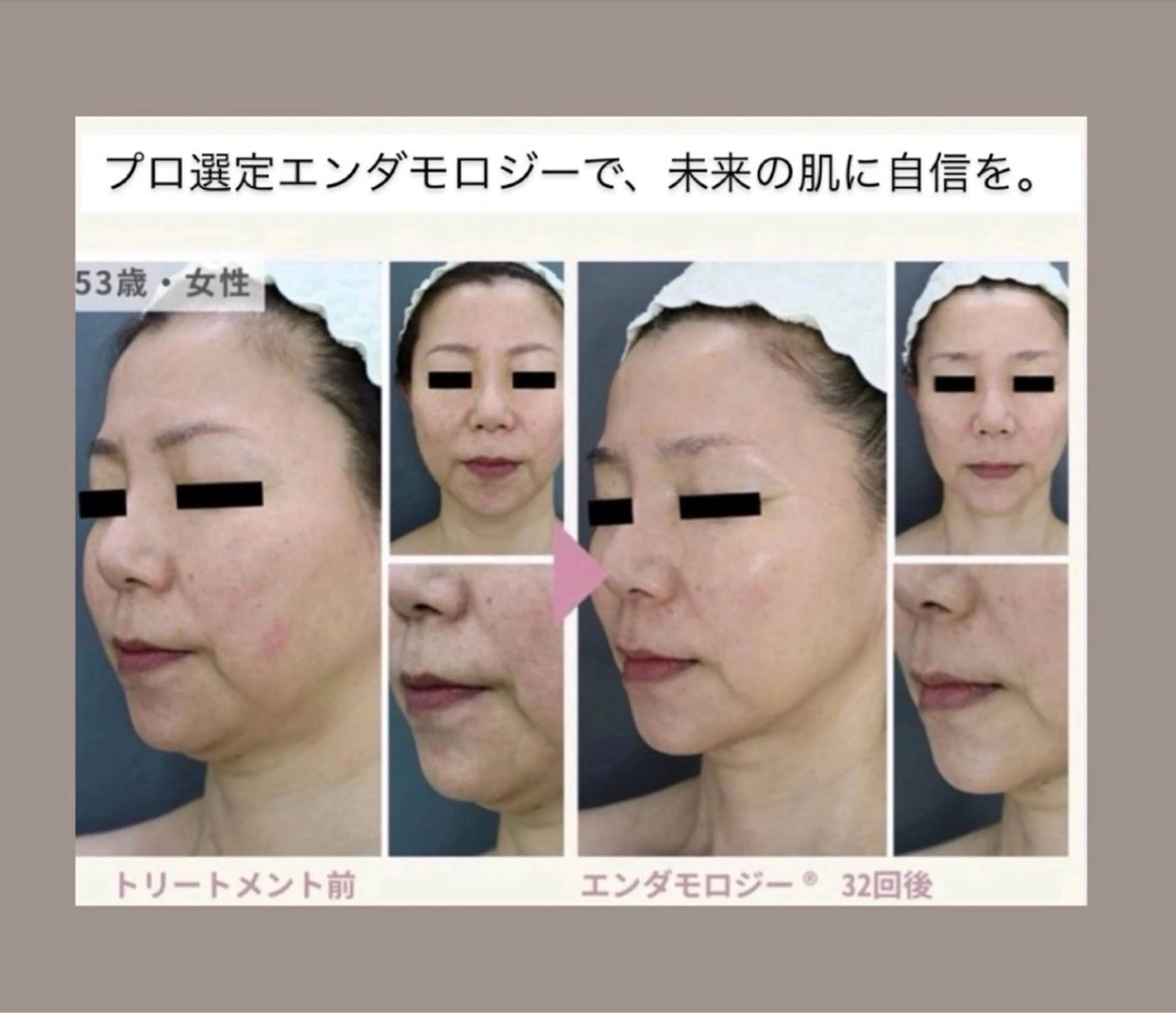 エステ Binosu所属・エンダモロジー BINOSUのエステ・リラクイメージ