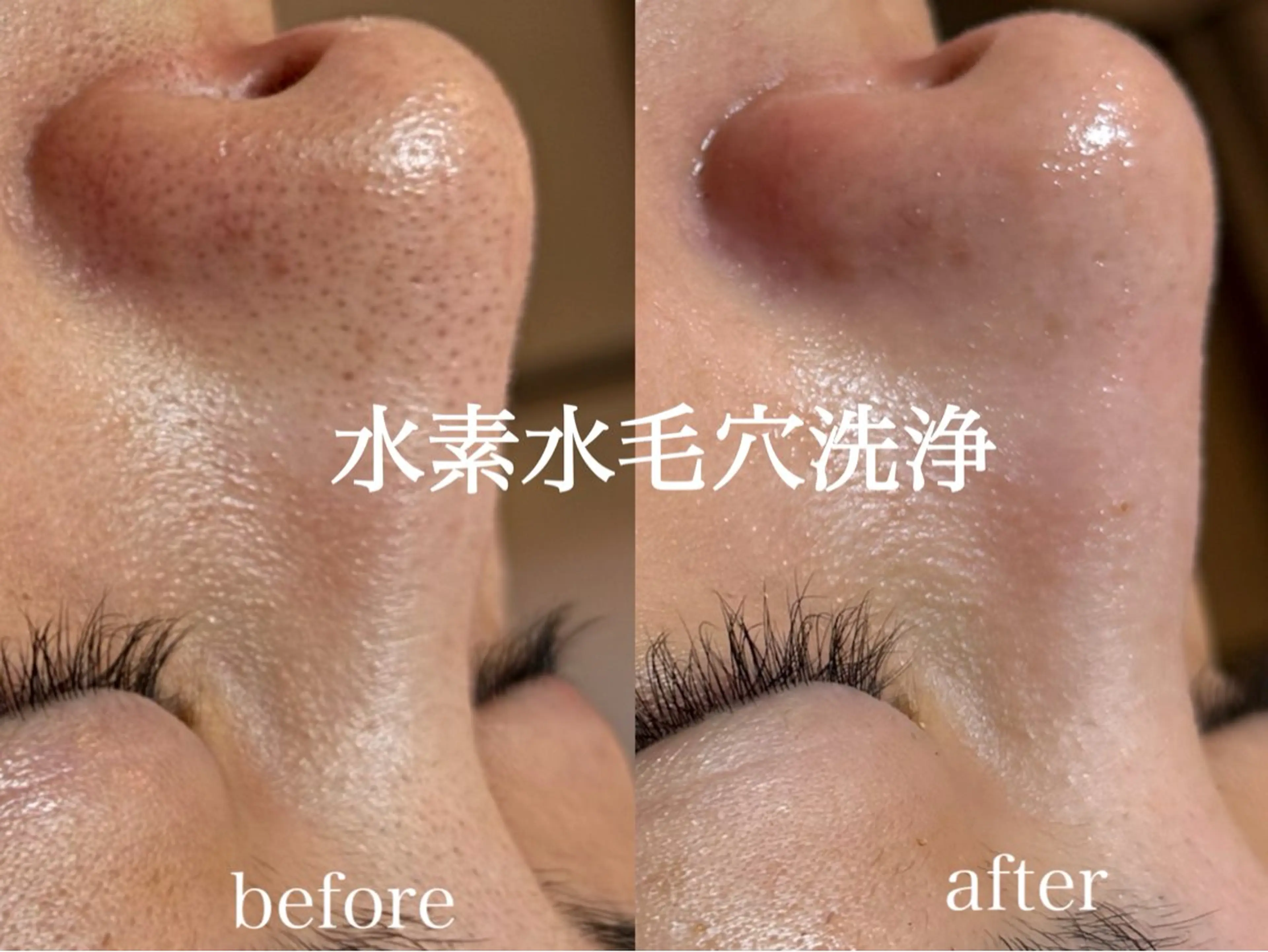 肌管理サロン neoriiのその他イメージ