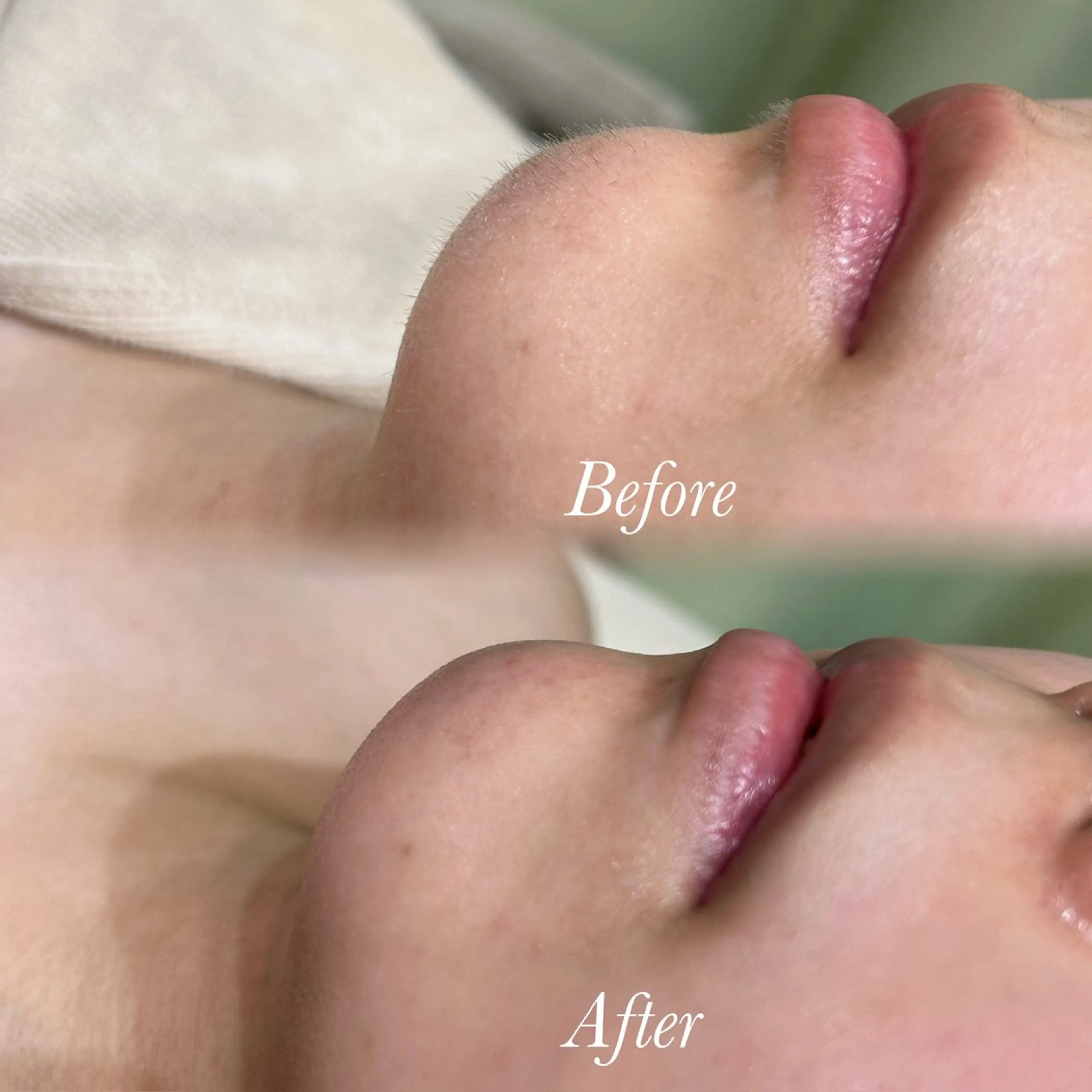 エステ リラク 🫧美しい素肌へ🫧 今成柚乃のその他イメージ