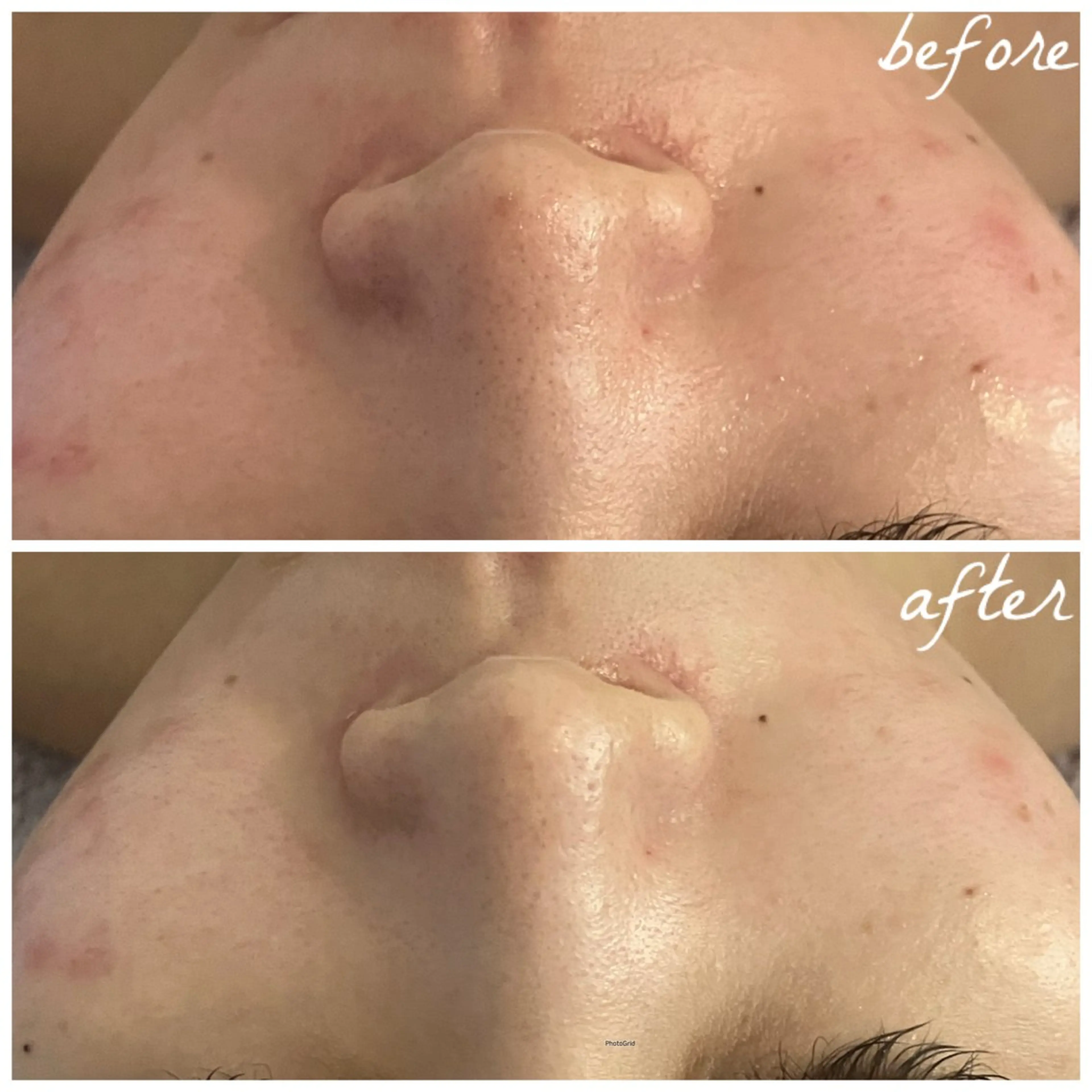 メンズ エステ メナード岐阜茜部 杉浦のエステ・リラクイメージ