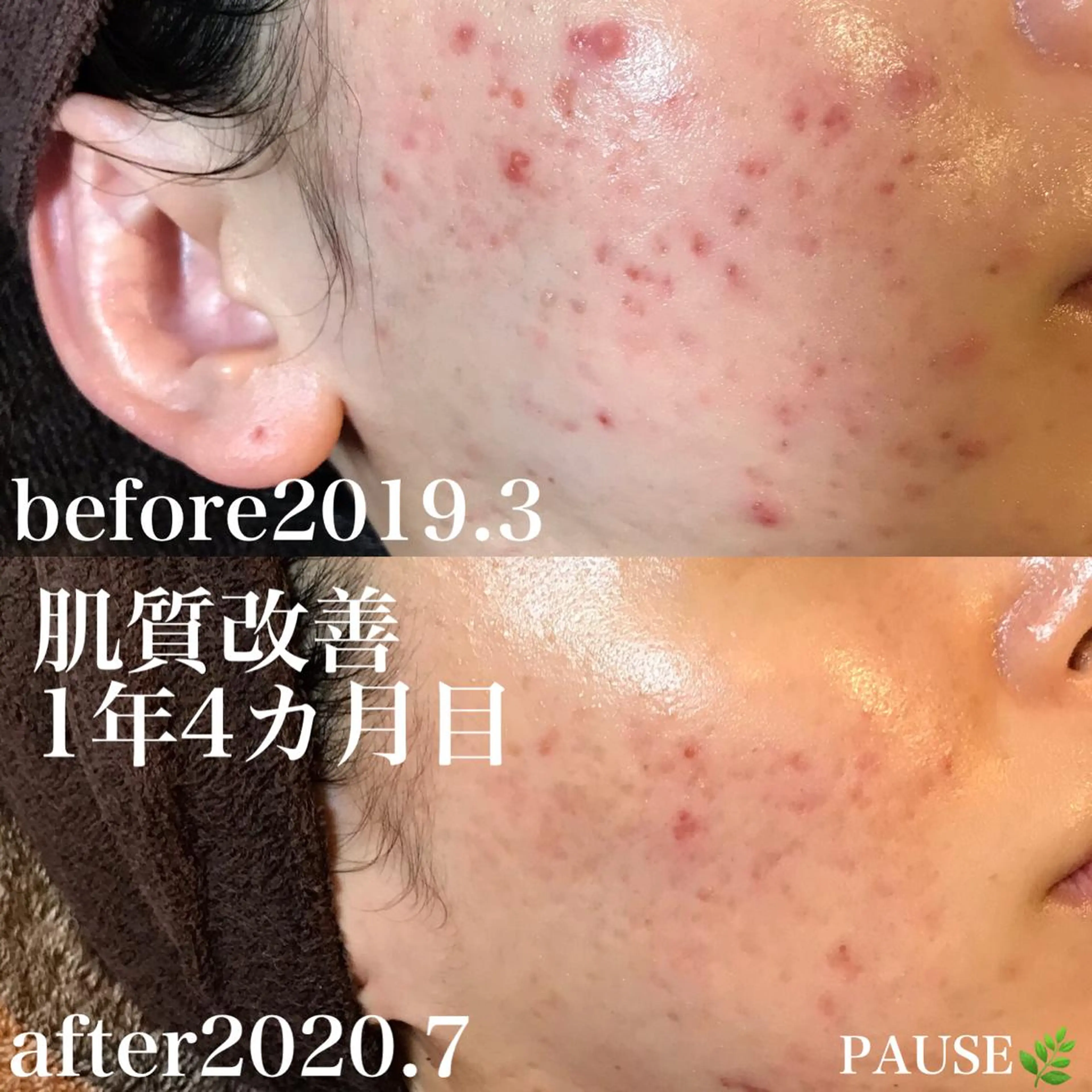 エステ 浜野 恵美のエステ・リラクイメージ