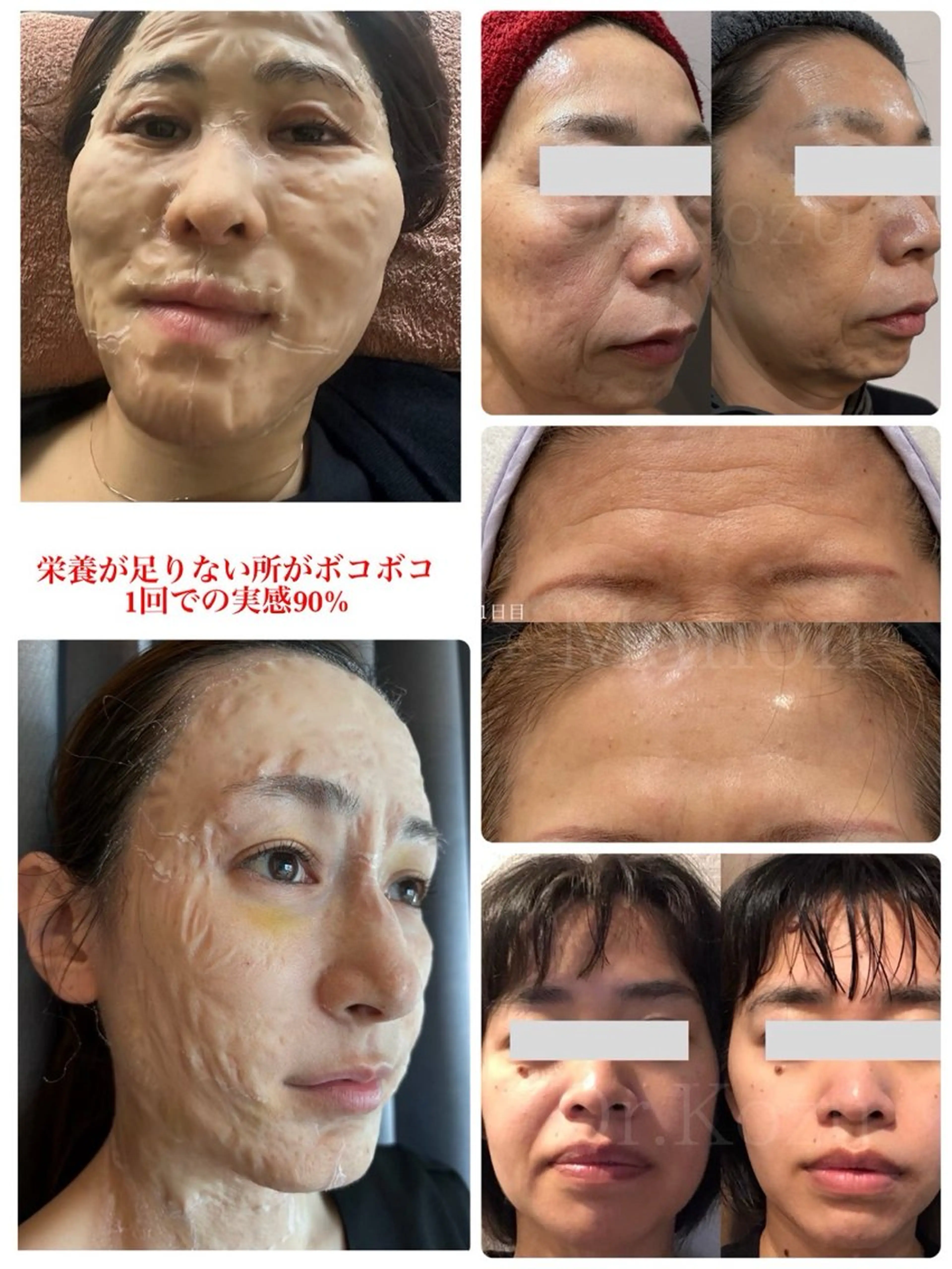 private salon  Dea_maris シュガーリング＆パーソナルボディケア所属・シミ改善・韓国肌管理 ボディメイク痩身のその他イメージ