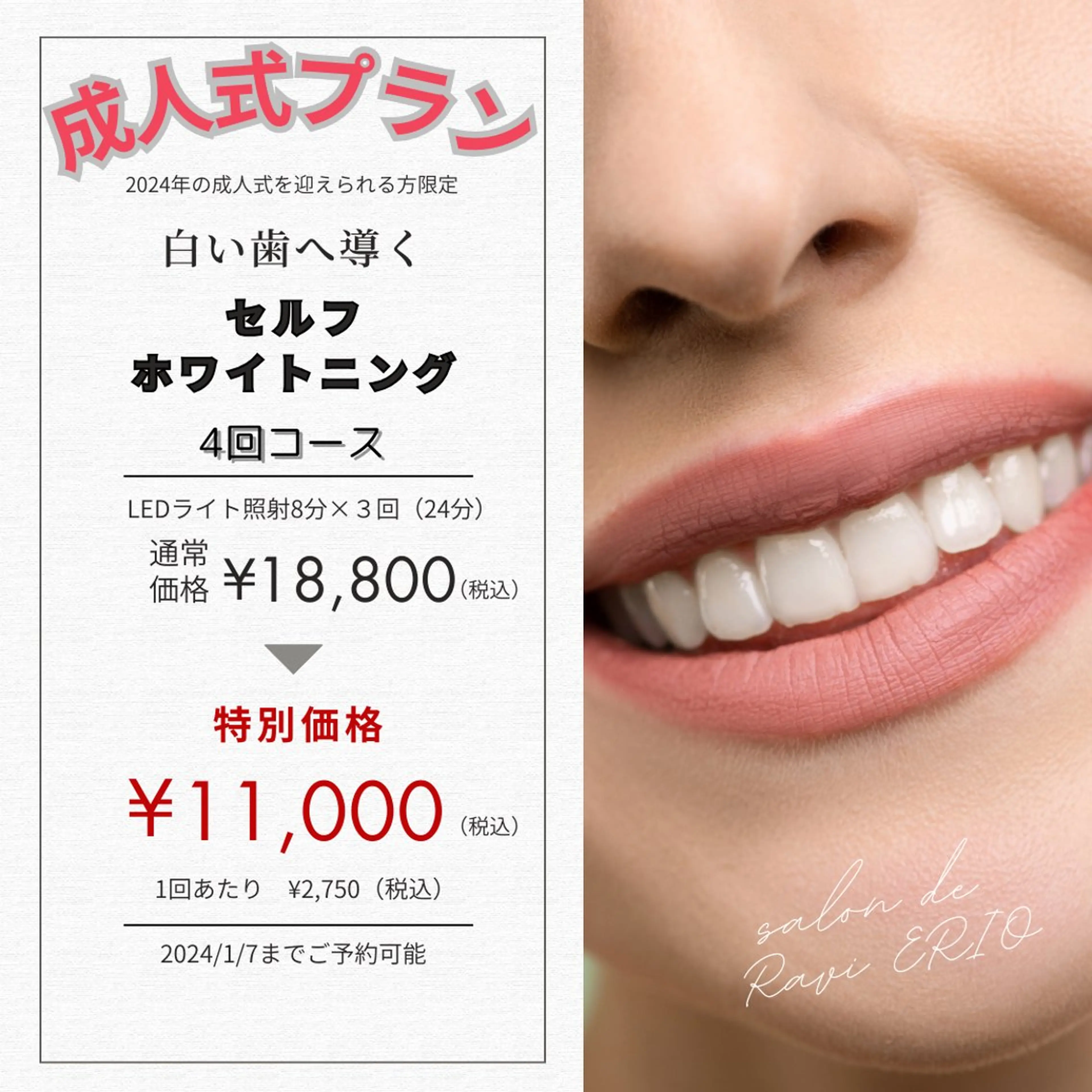 サロン ド ラヴィ エリオのその他イメージ