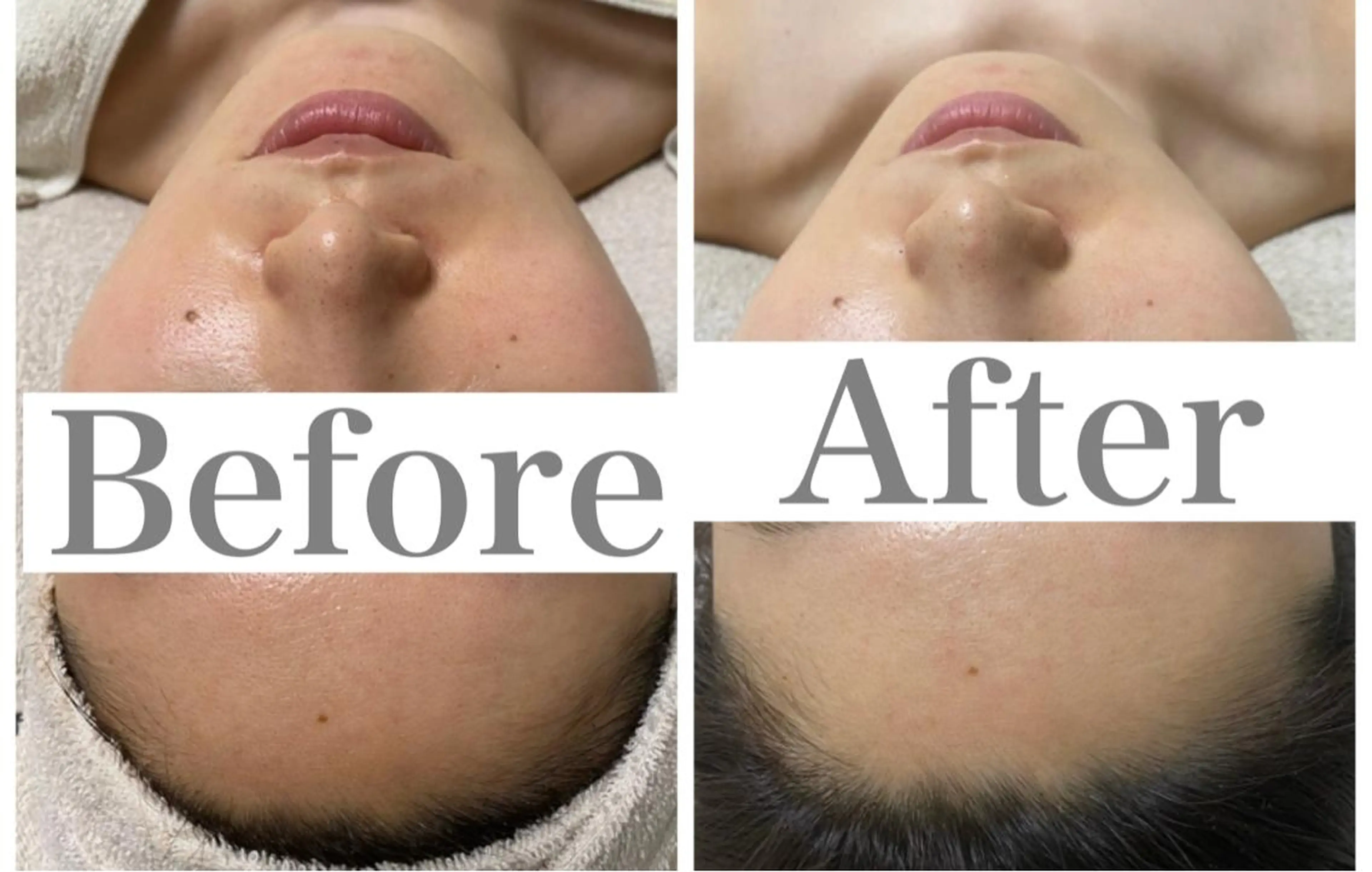 ✨オープン記念✨陶肌トリートメントハーブ🌿2g  🎁シルクパウダー、CYリキッド　各2回分、リバイバルローション🎁の写真