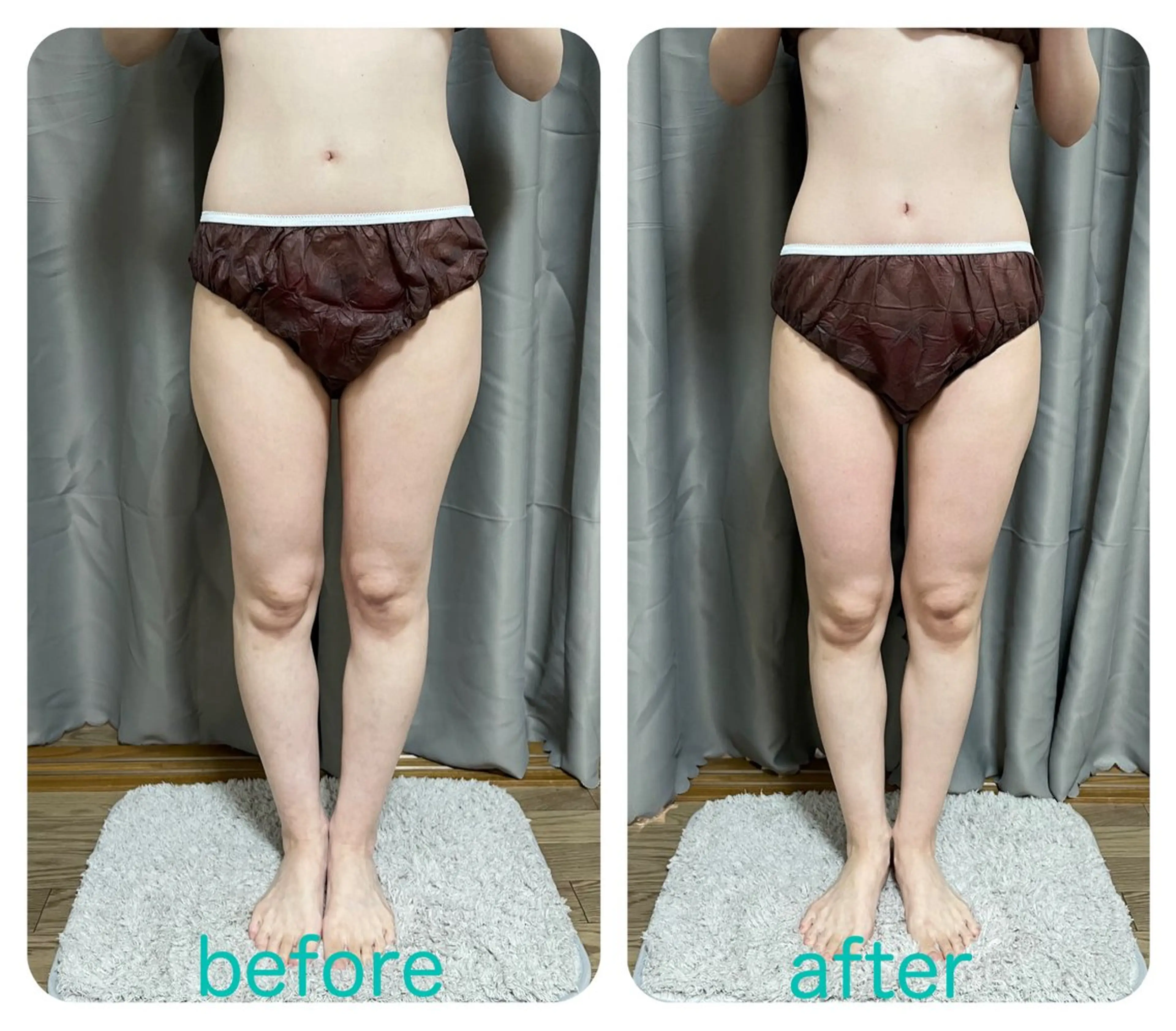 Loar 【痩身/小顔エステサロン】所属・Loar エステ中野 絵里奈のエステ・リラクイメージ