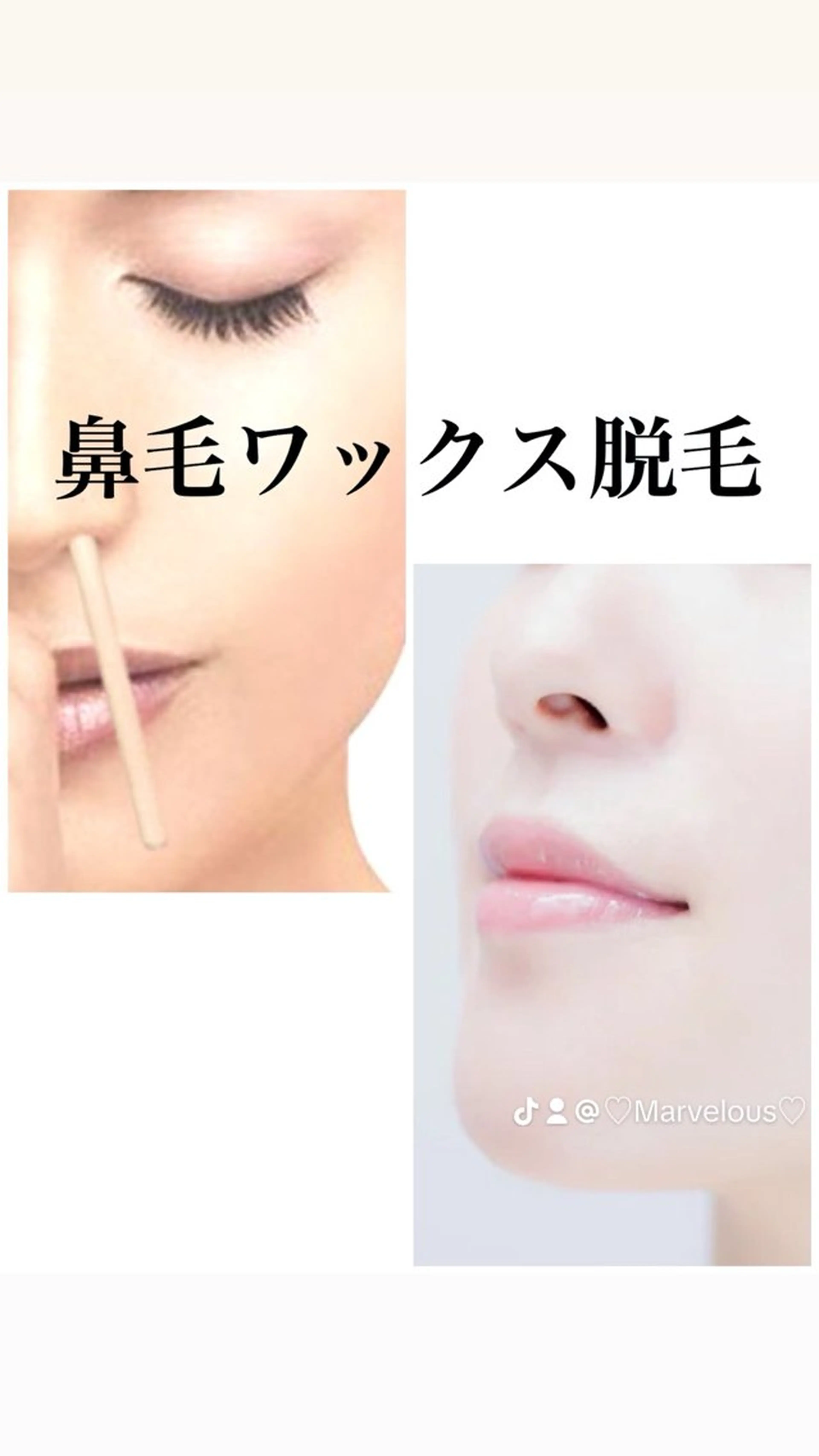 (ワックス脱毛)鼻毛の写真