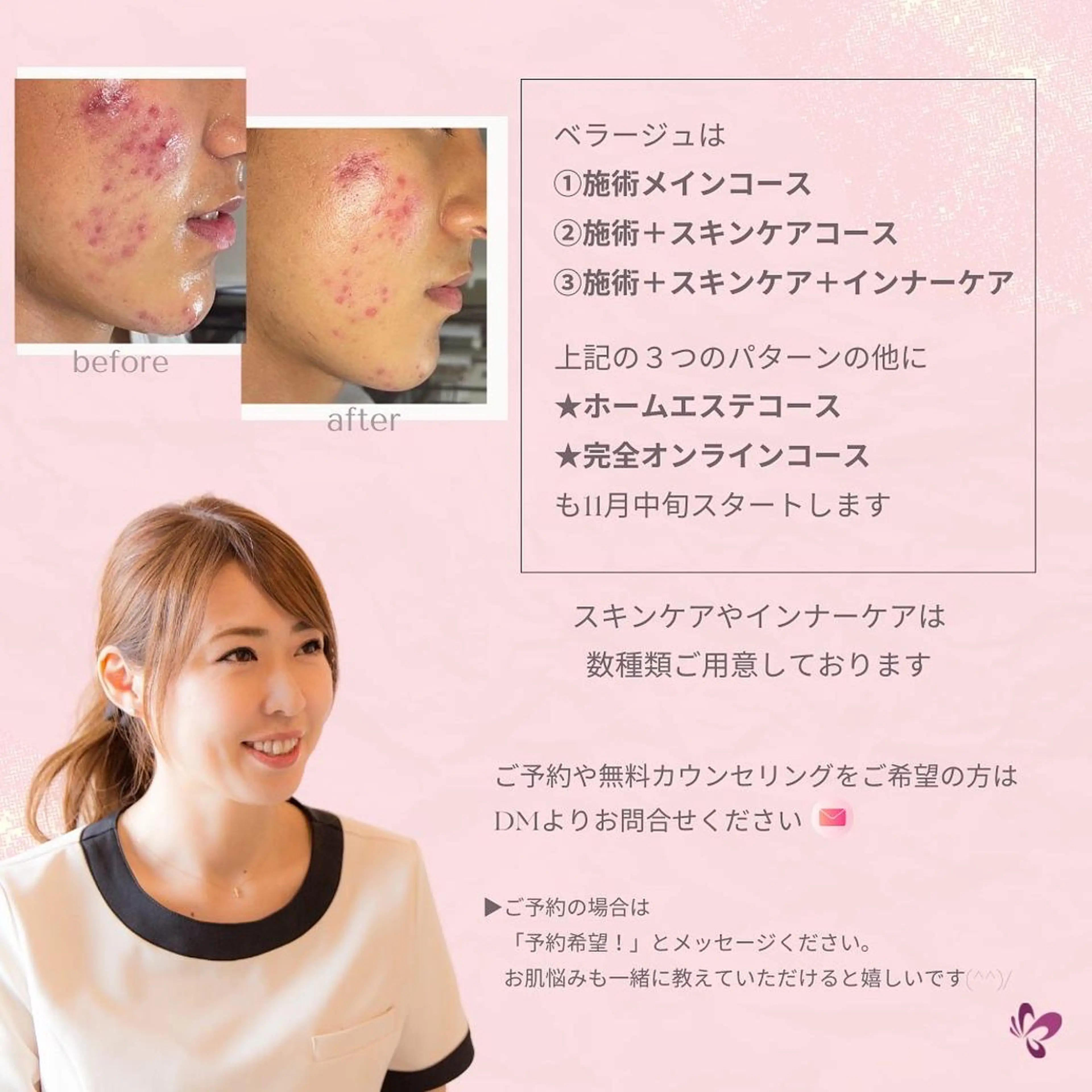 ベラージュ【美背中・ 美尻・フェイシャル】のエステ・リラクイメージ