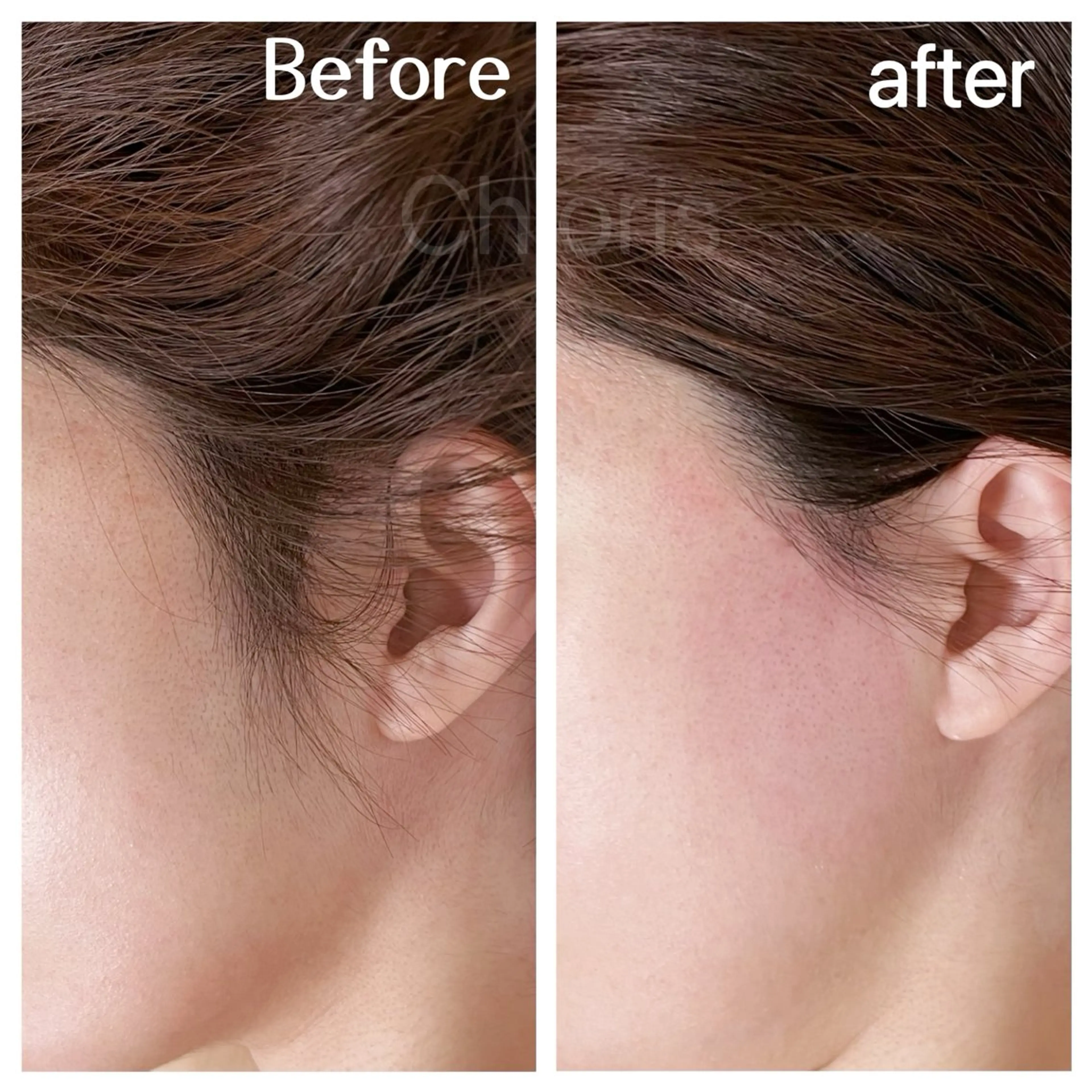 川越ローマピンク 光脱毛＆ワックス脱毛のエステ・リラクイメージ