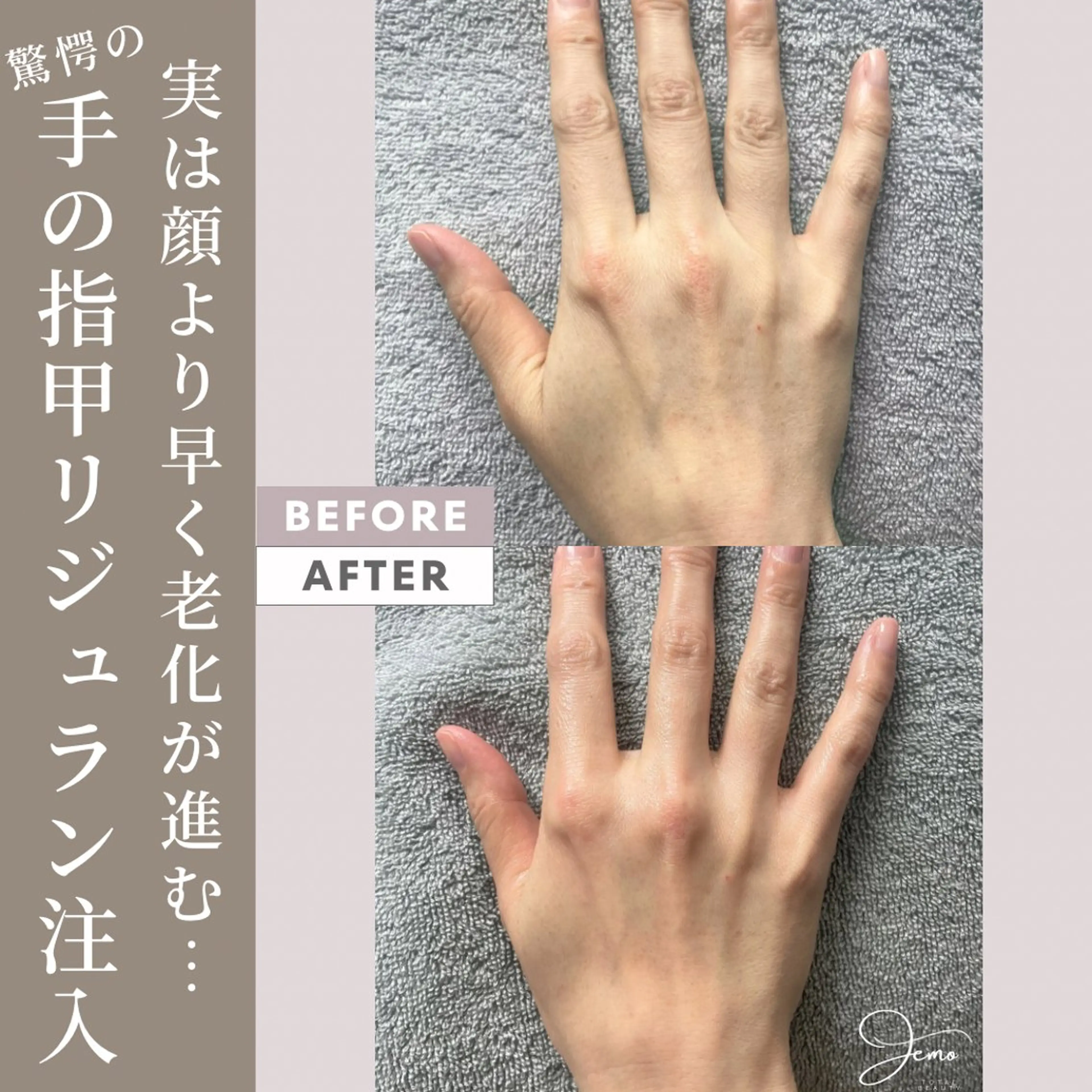 脱毛&増毛&肌管理サロンJemo所属・脱毛増毛肌管理サロン Jemoのエステ・リラクイメージ