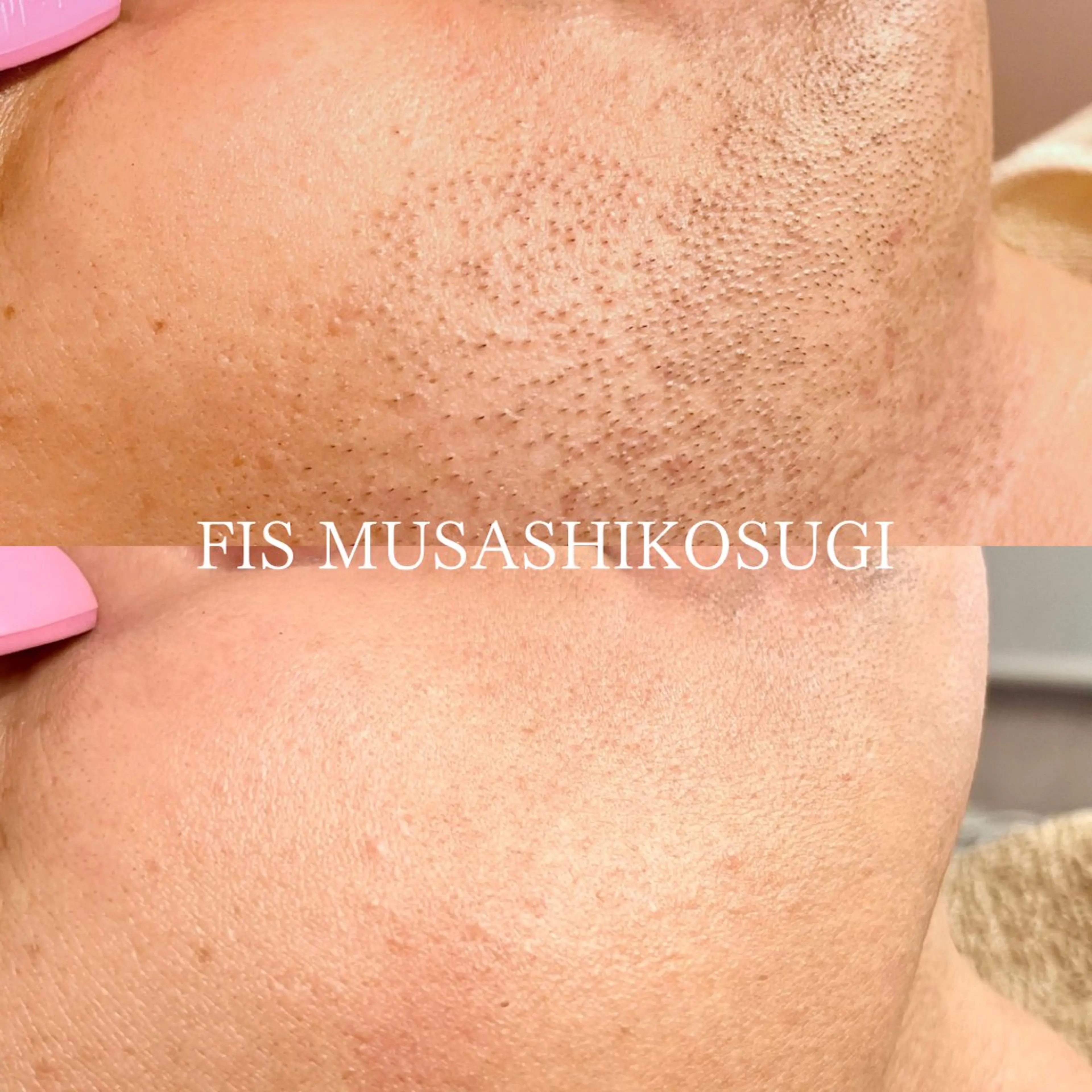 脱毛サロン&ハーブピーリングFIS武蔵小杉店所属・脱毛サロン FIS武蔵小杉店のエステ・リラクイメージ