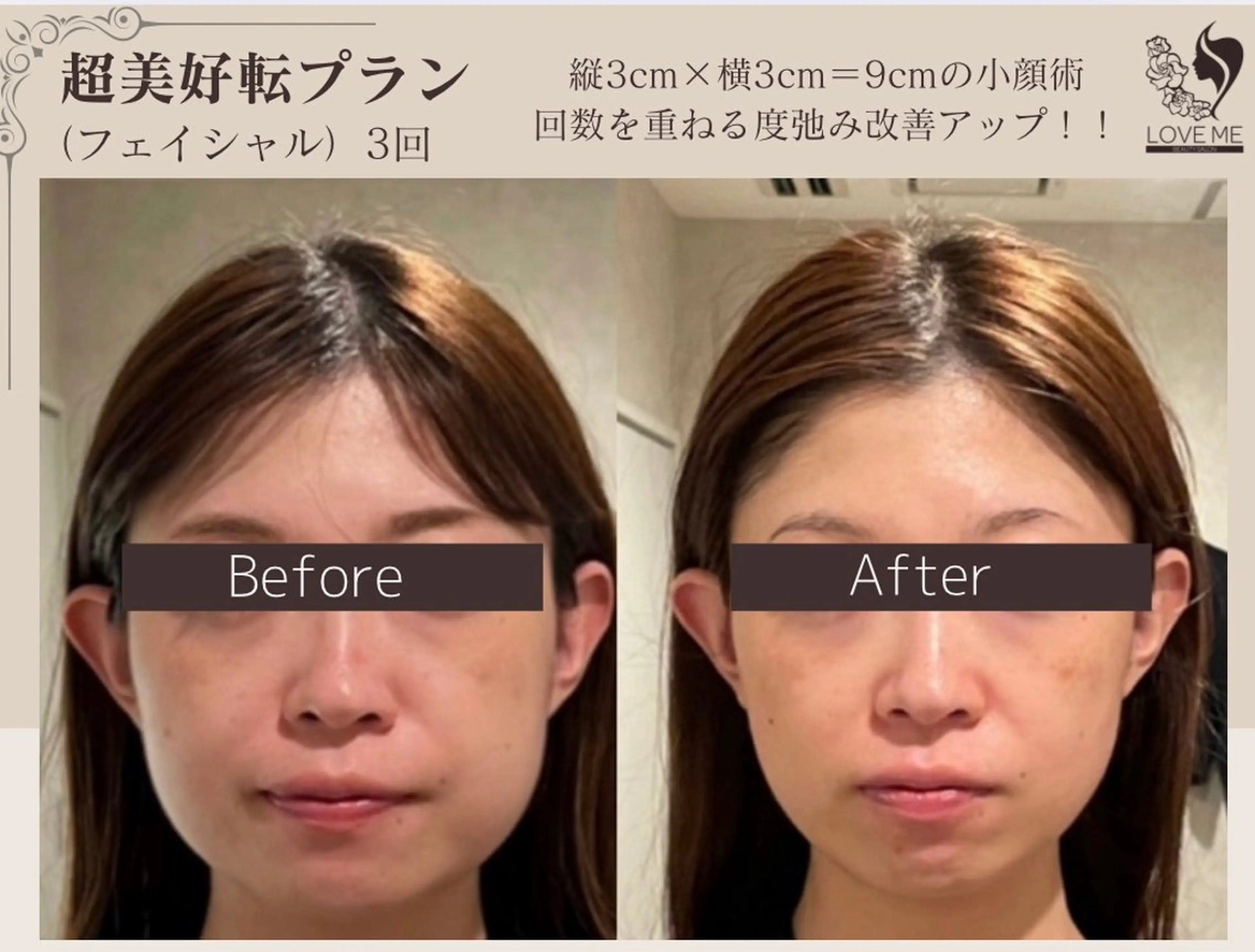 エステ 総合美容サロン LOVEME渋谷本店のエステ・リラクイメージ