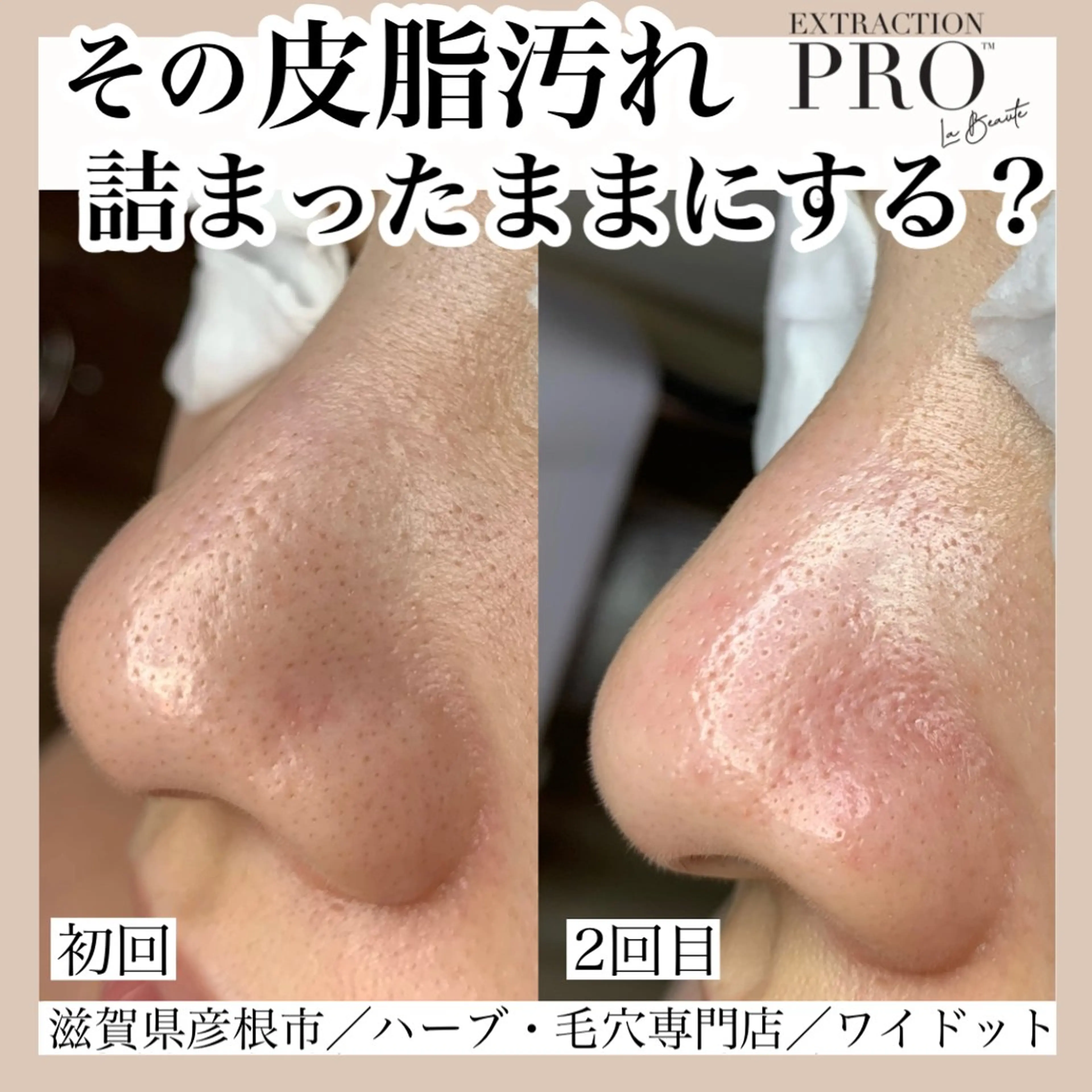 エステ Ydot. 池内 友架のエステ・リラクイメージ