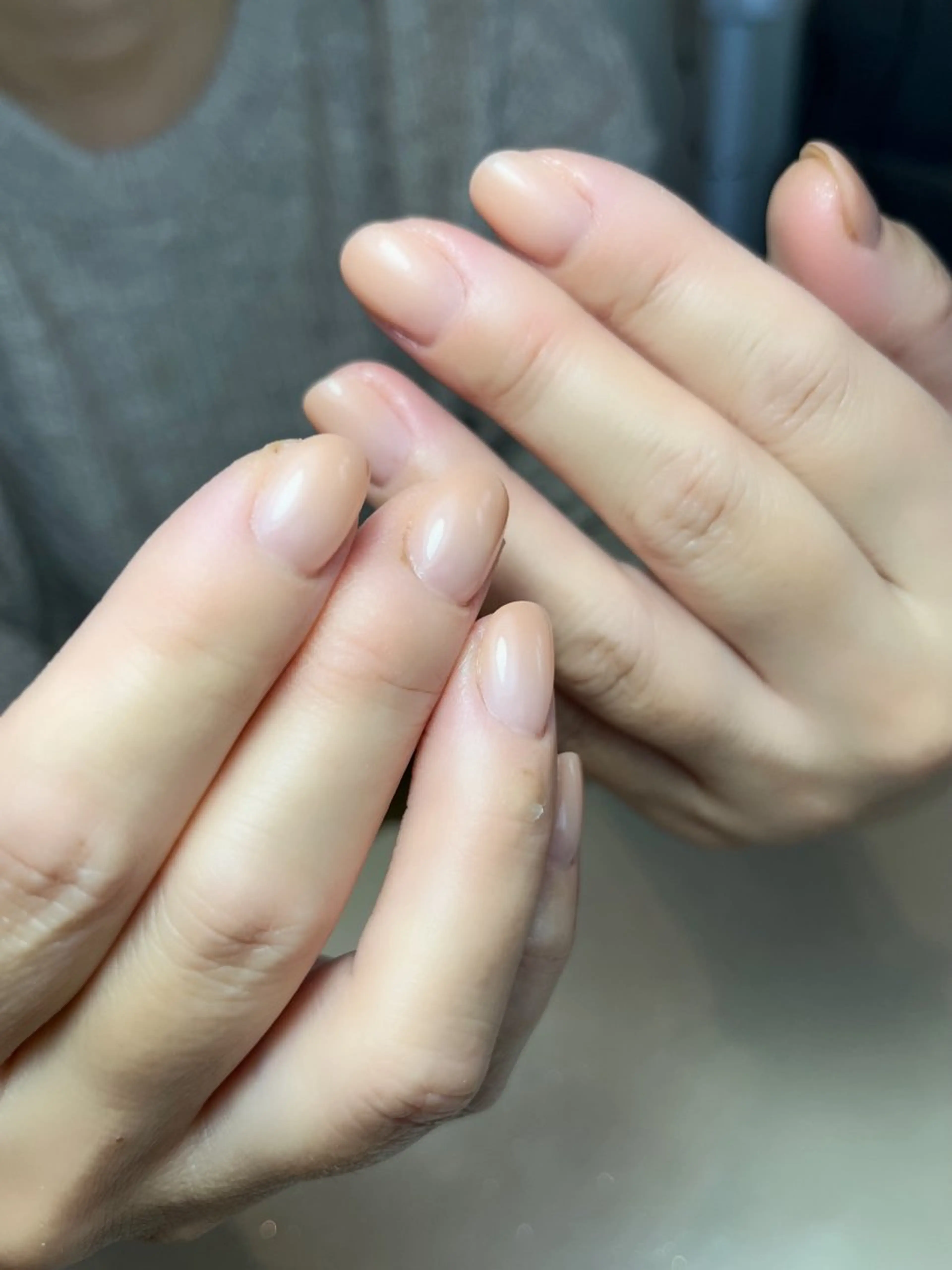 ネイル ハンドネイル 𝐴𝑁𝑈𝐸 トラブル爪育成専門のネイルデザイン