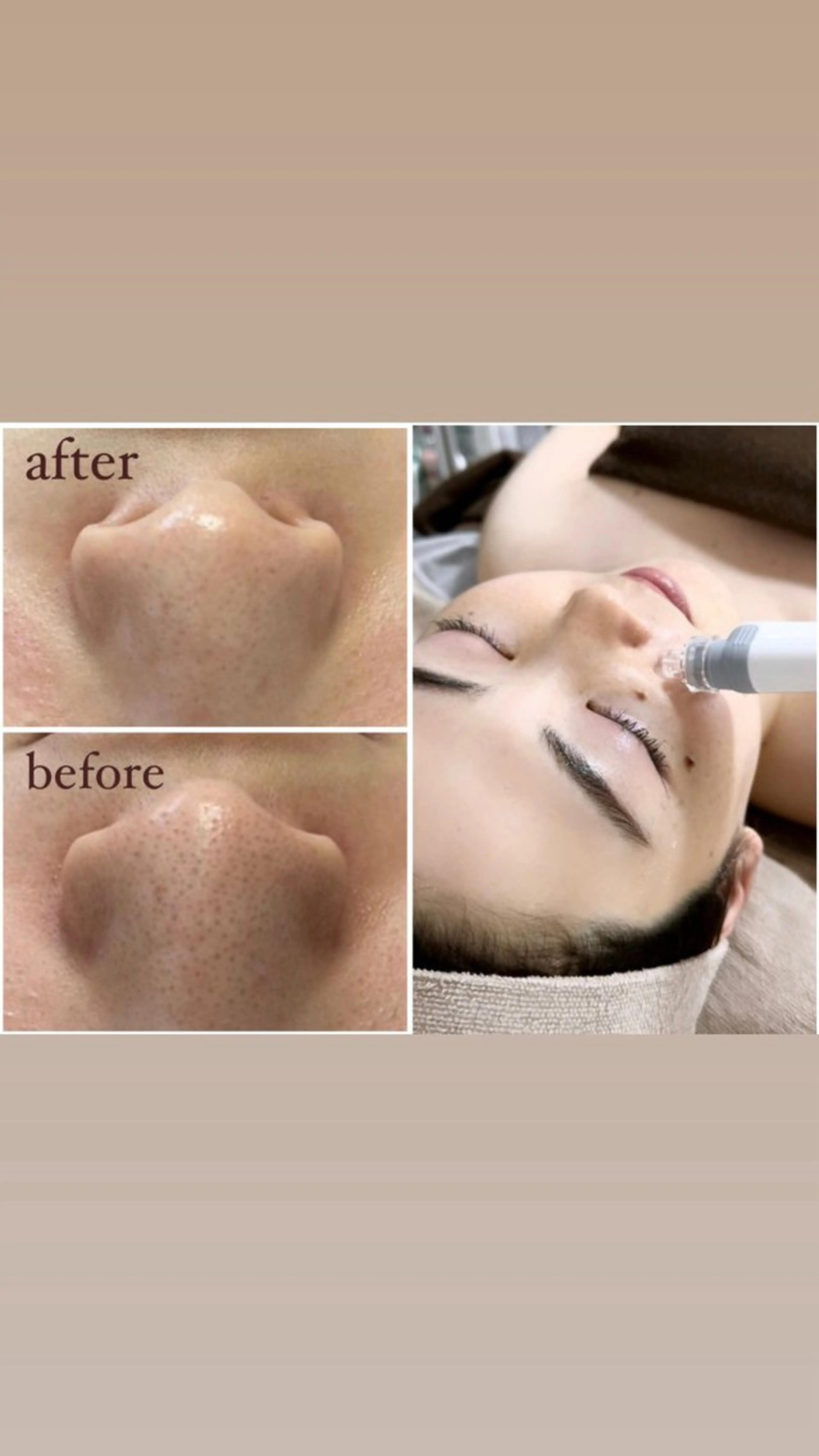 crescent所属・【韓国肌管理・脱毛】 クレセントのエステ・リラクイメージ