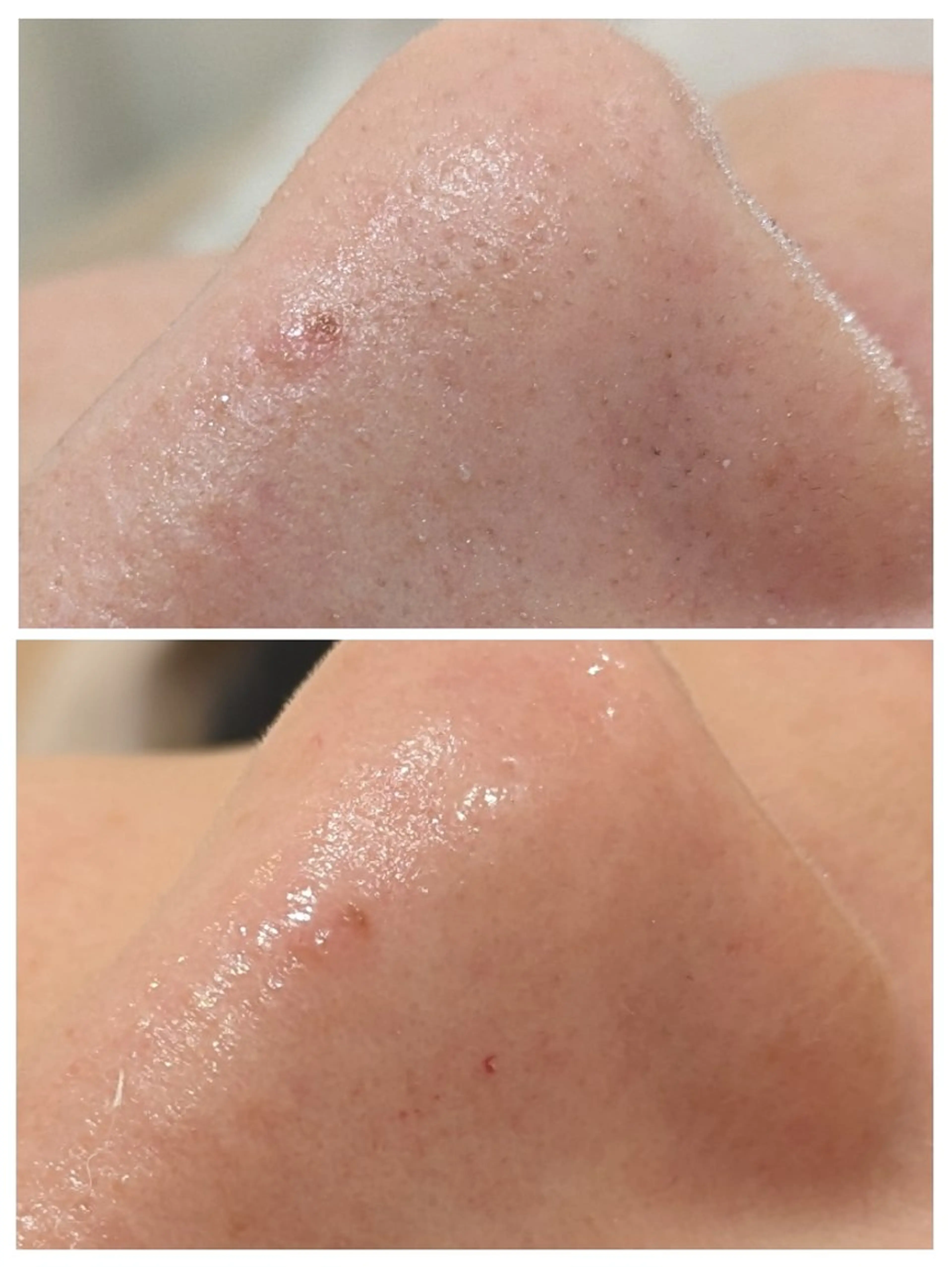 babyaiai所属・babyaiai 　momo🍑のエステ・リラクイメージ