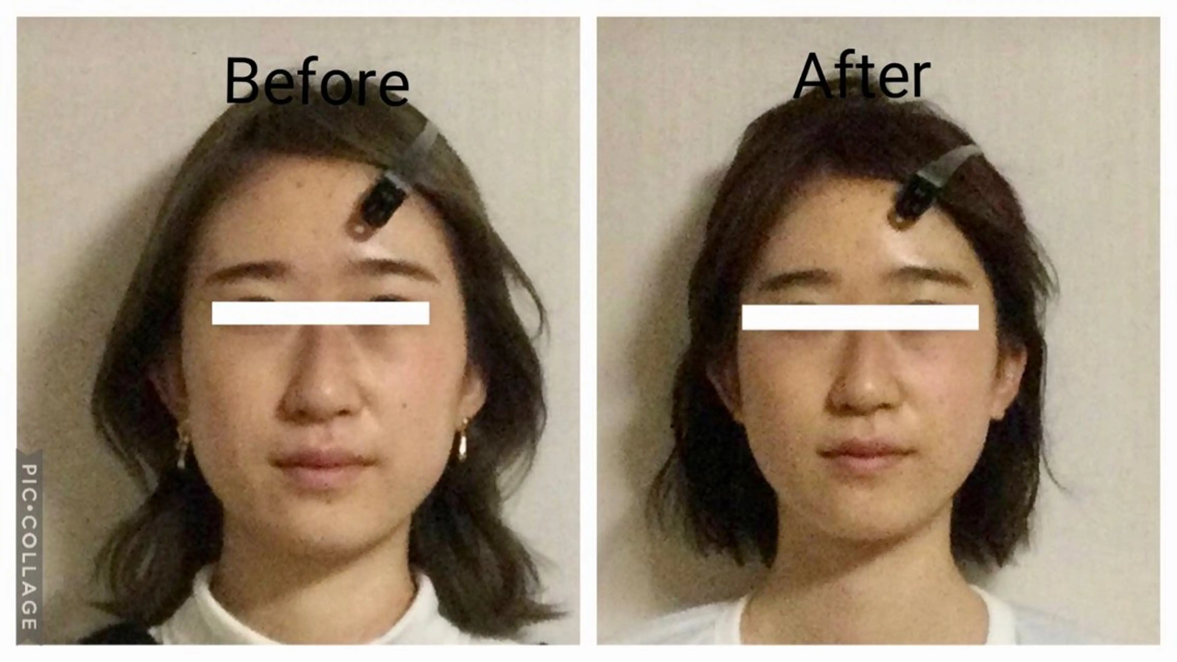 エステ リラク 小顔矯正Sho  FaceDesignのエステ・リラクイメージ