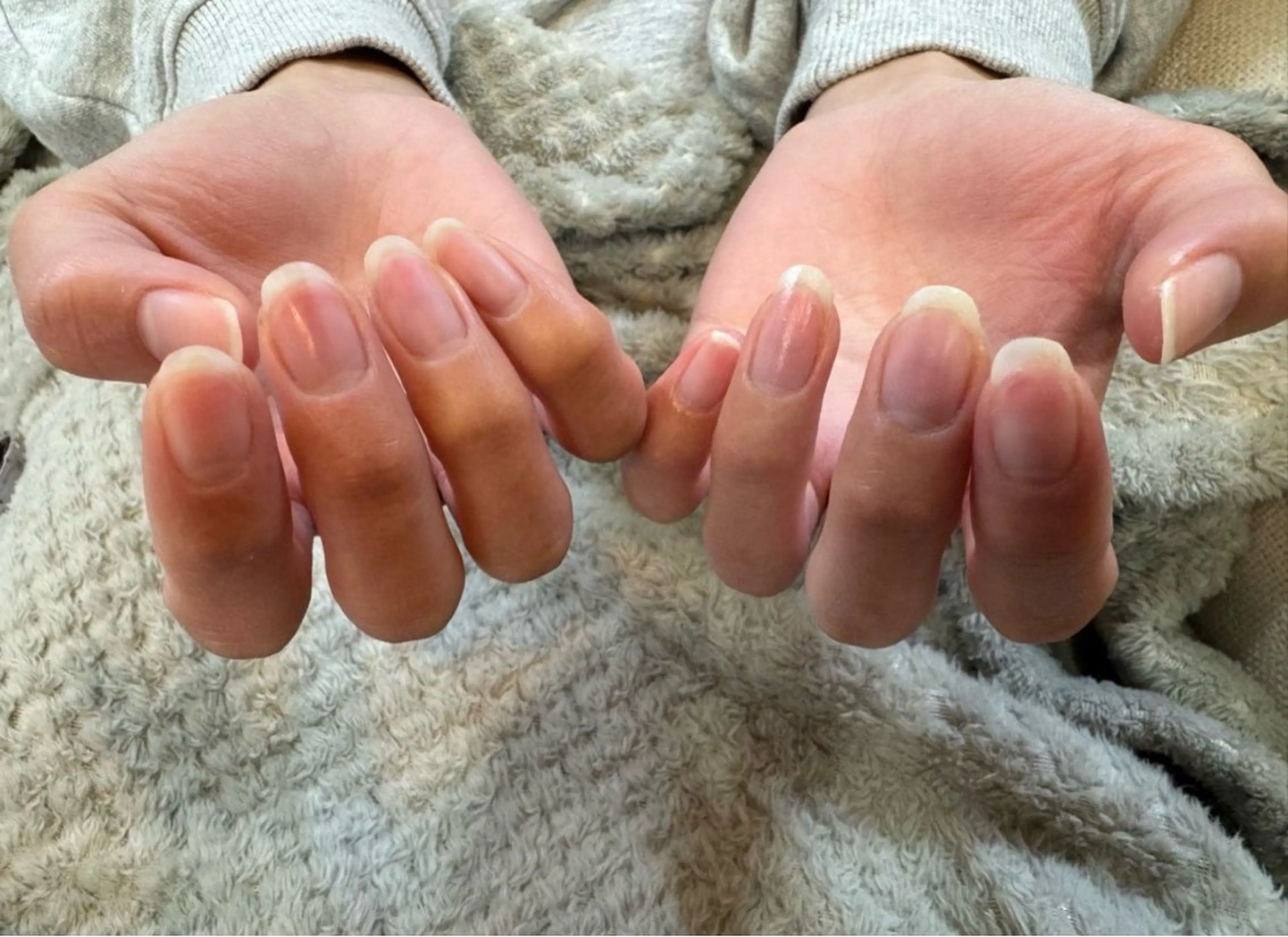 ジェルオフのみの写真