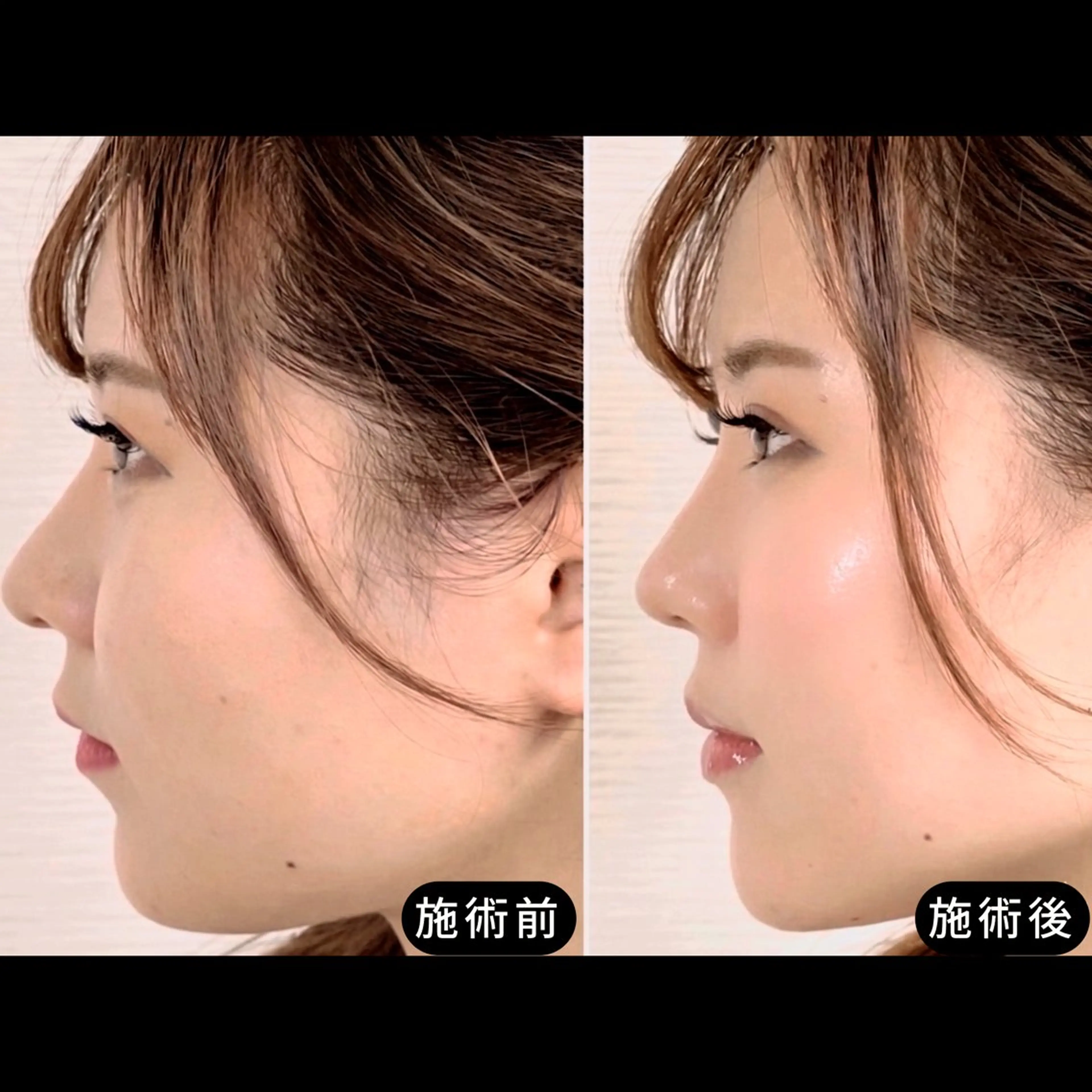 エステ リラク 渋谷 小顔美容鍼 専門サロン YZのエステ・リラクイメージ