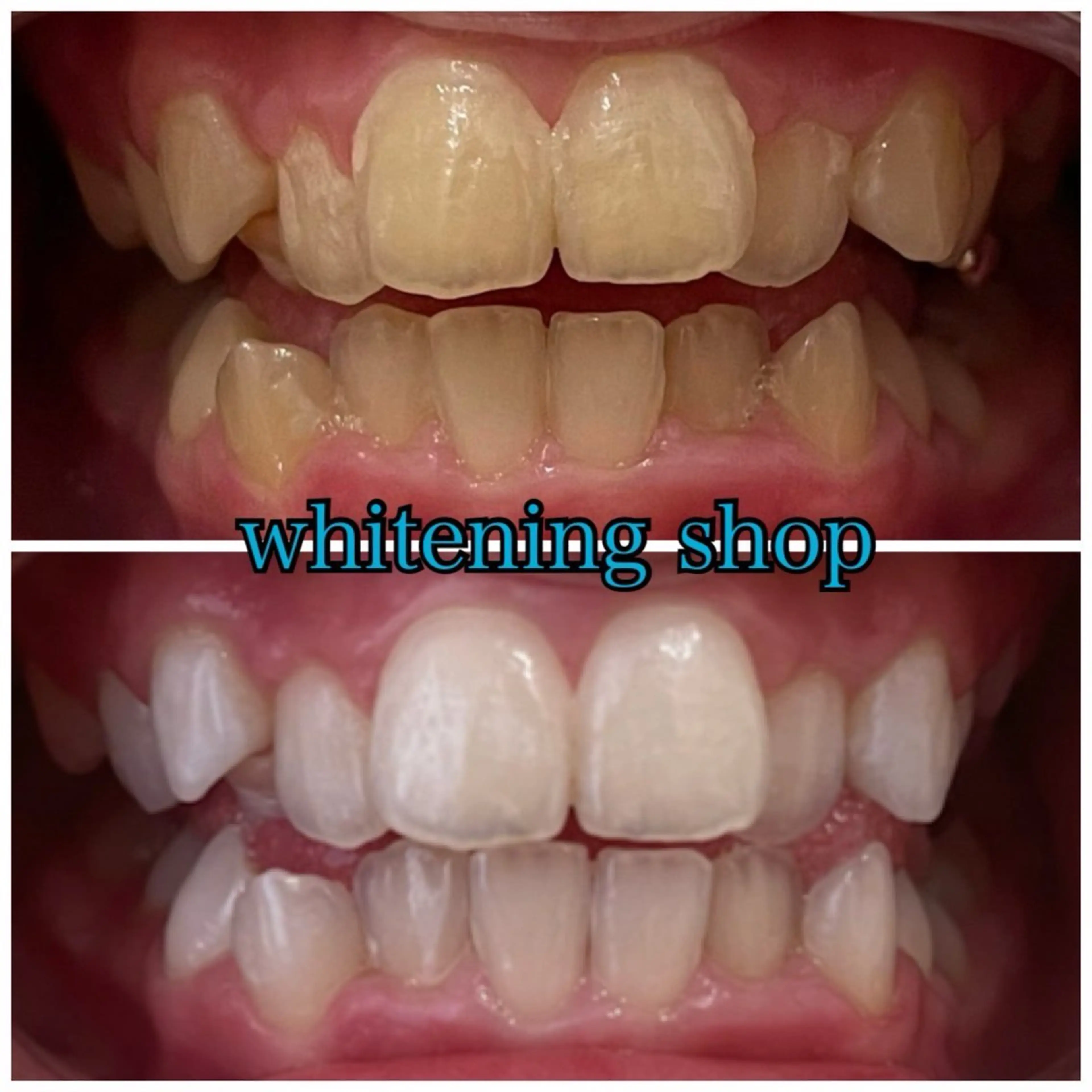 メンズ エステ リラク ホワイトニング ショップ川越店のエステ・リラクイメージ