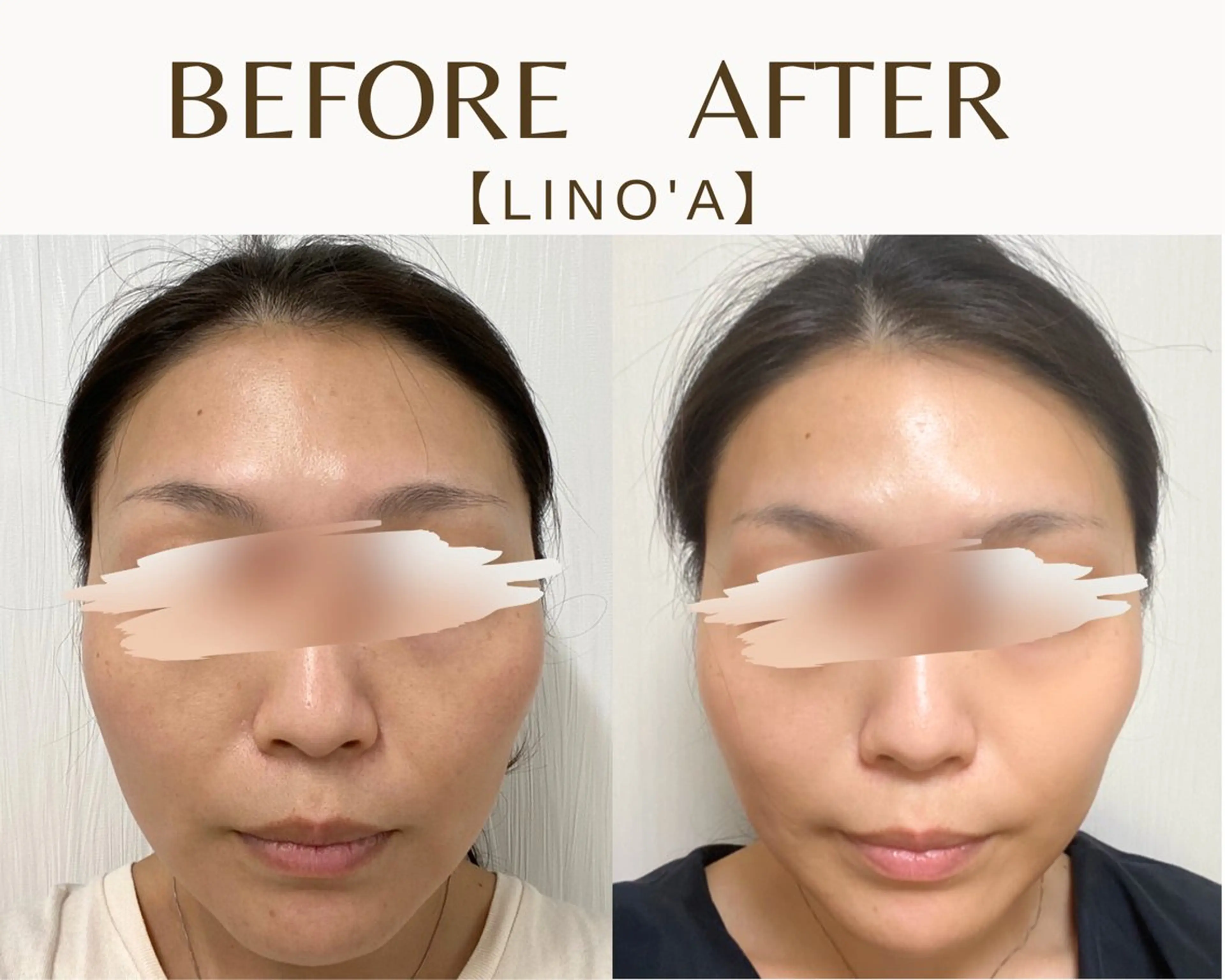 エステ リラク Salon💫 Lino'a柏店のエステ・リラクイメージ