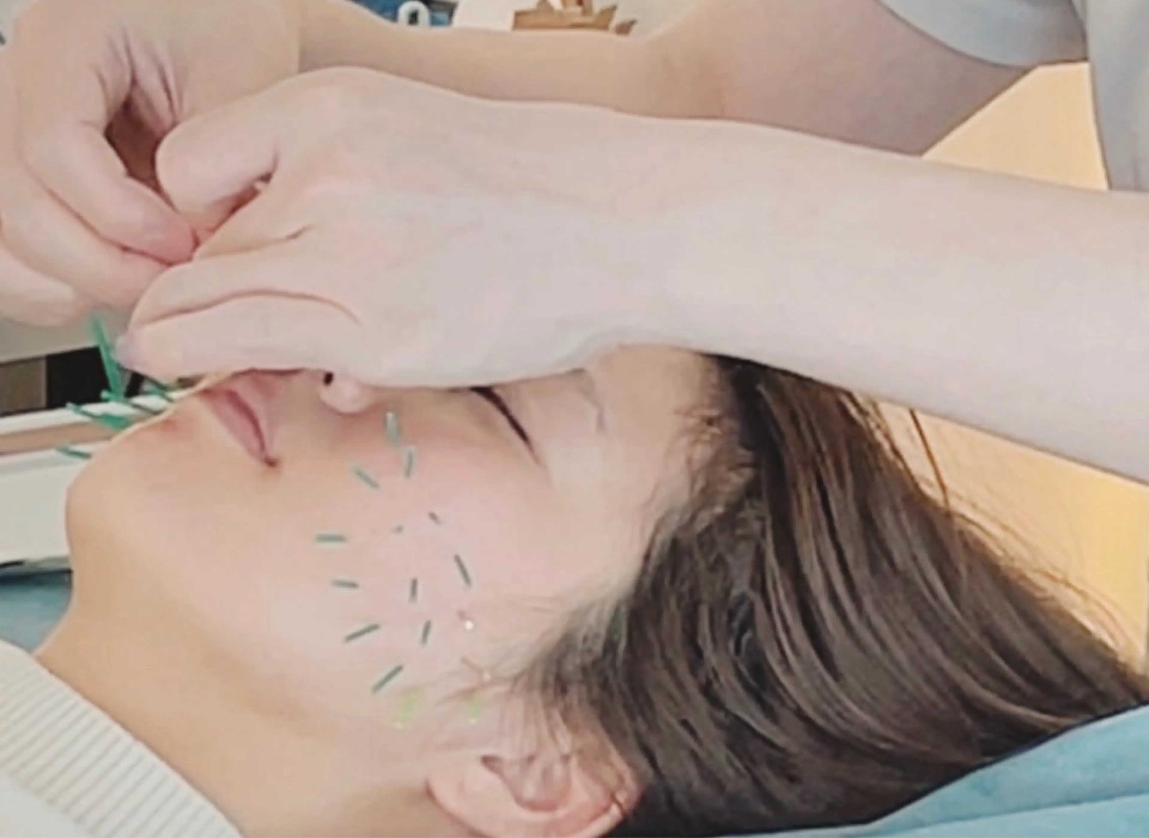 【顔のゆがみケア】ボキボキなし骨盤つき小顔EMS美容鍼 70分の写真