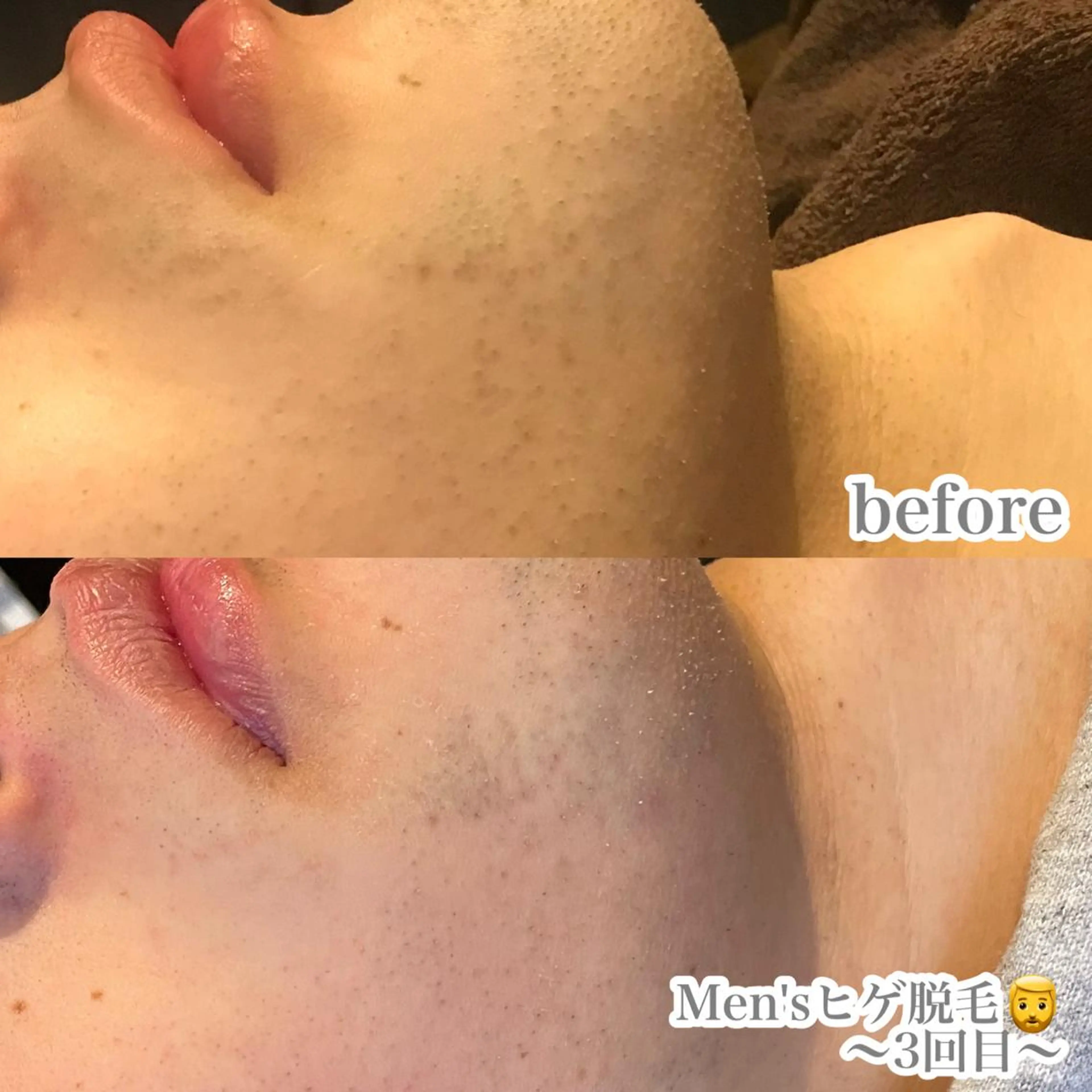 脱毛 浜野 恵美のエステ・リラクイメージ